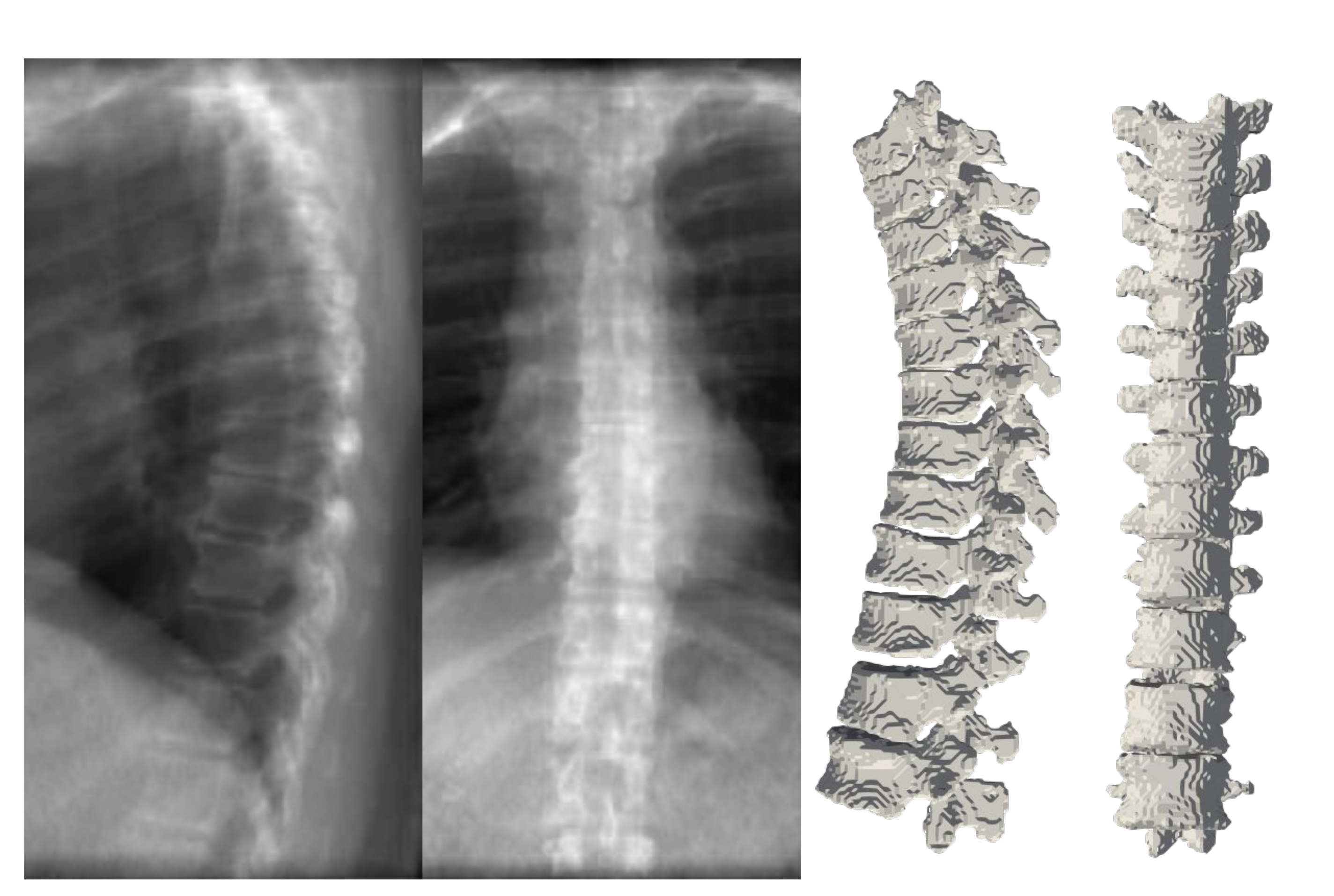 Tomography 08 00039 g008