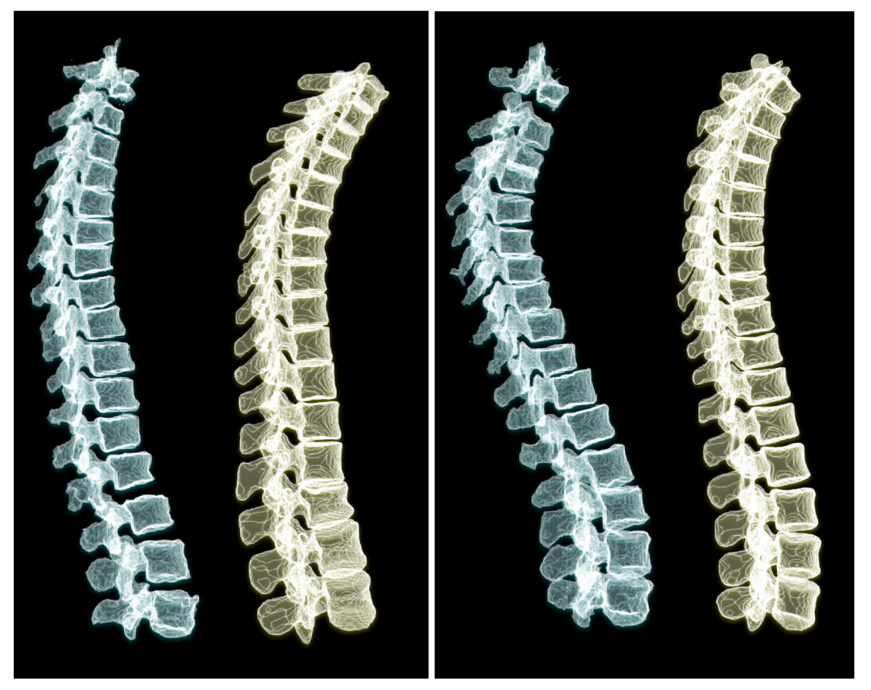 Tomography 08 00039 g012