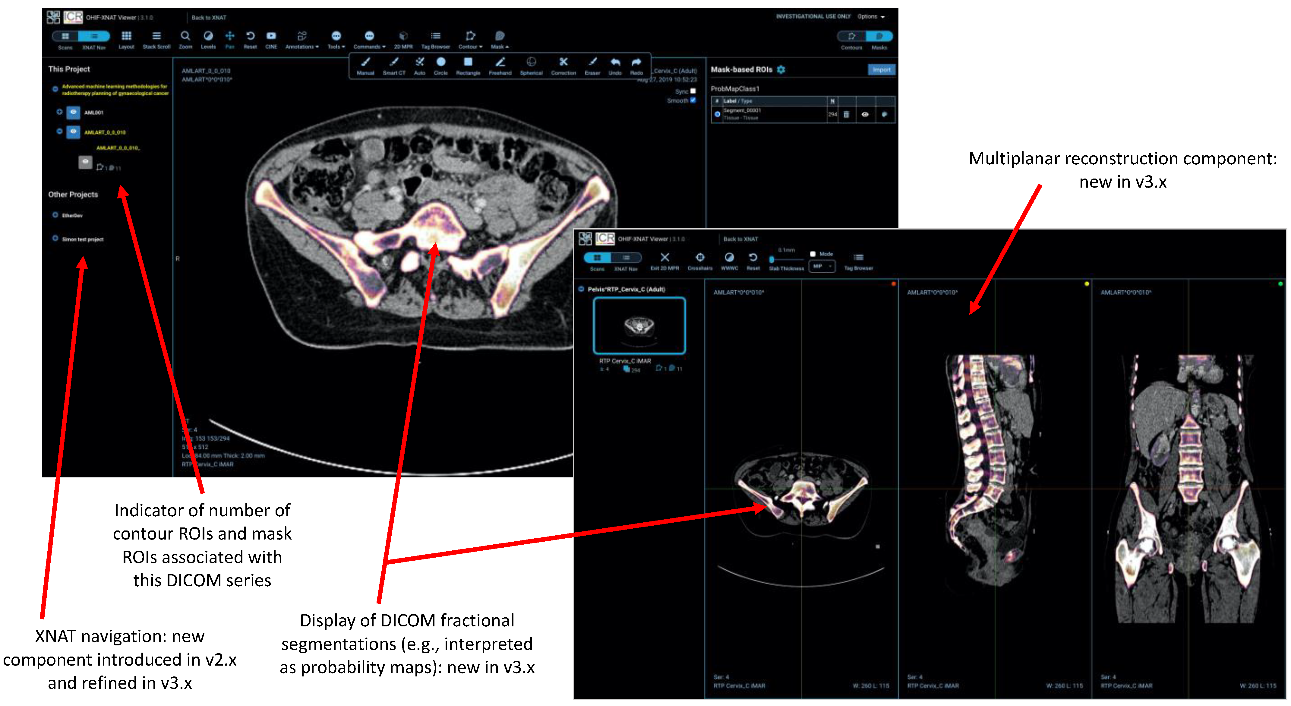 Tomography 08 00040 g004 550