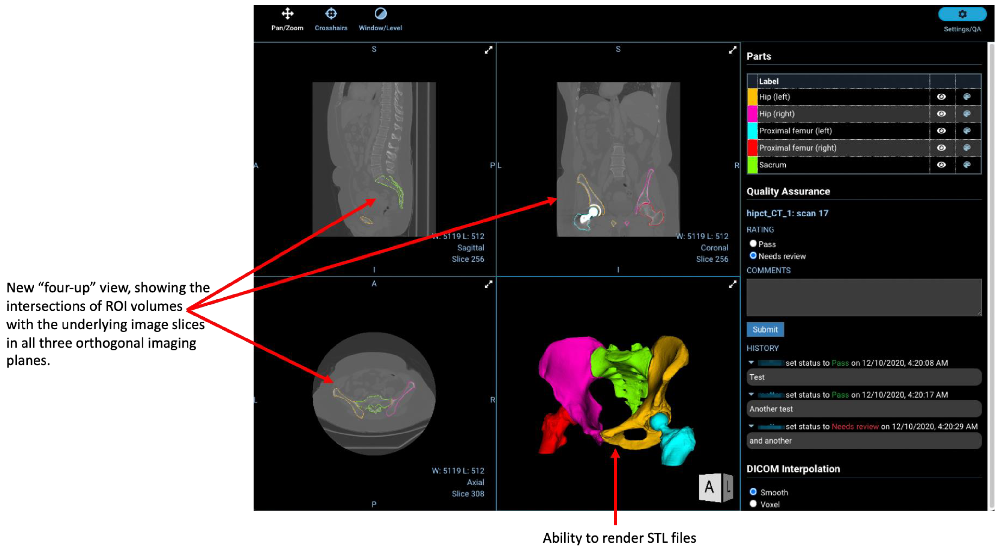 Tomography 08 00040 g005 550