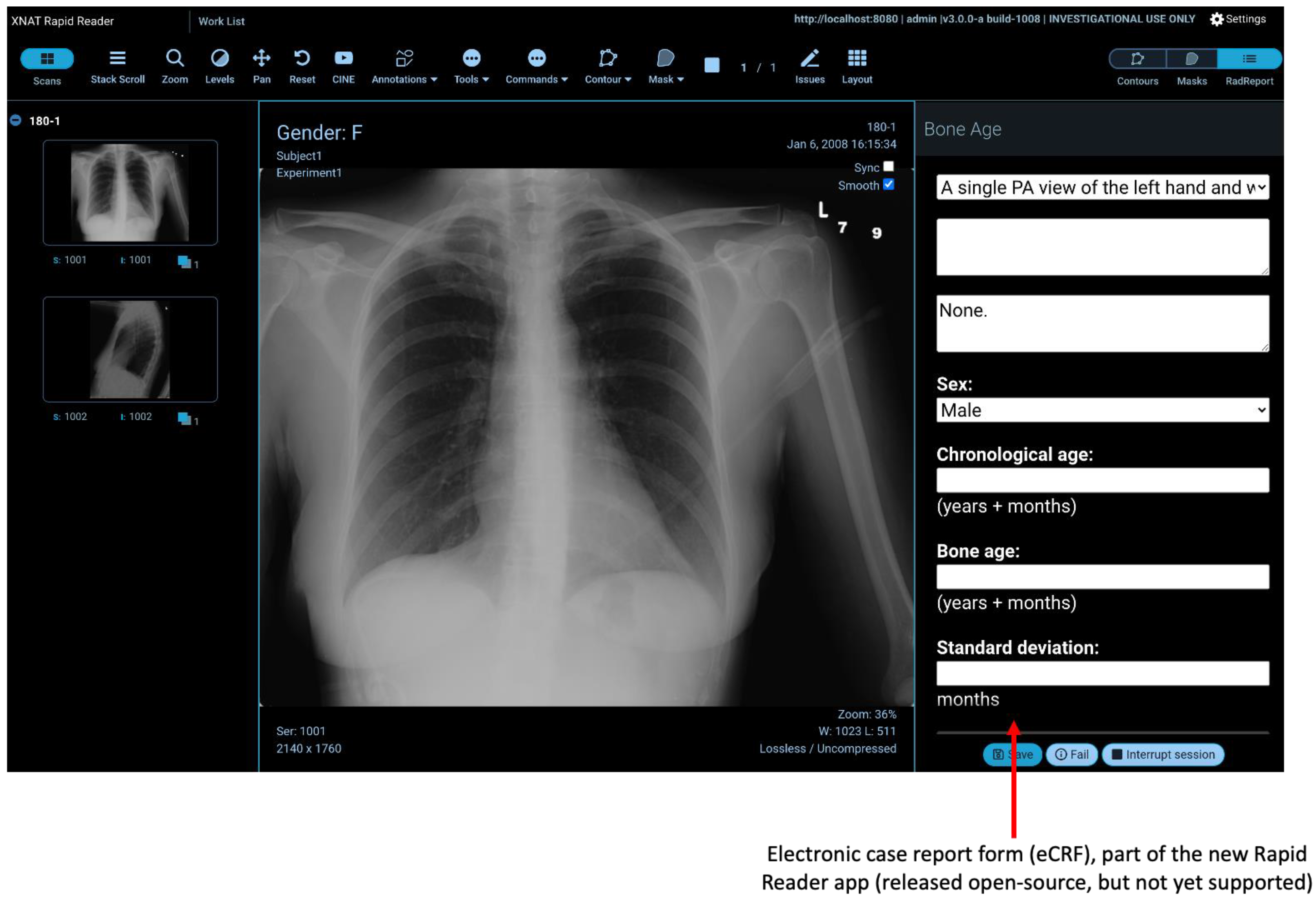 Tomography 08 00040 g007b 550