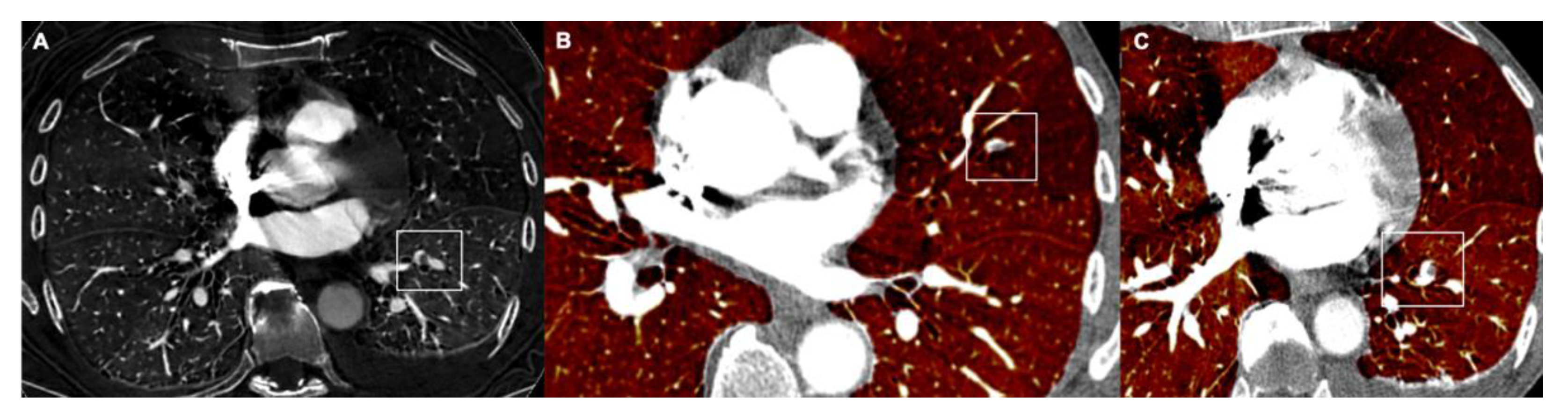 Tomography 08 00042 g005