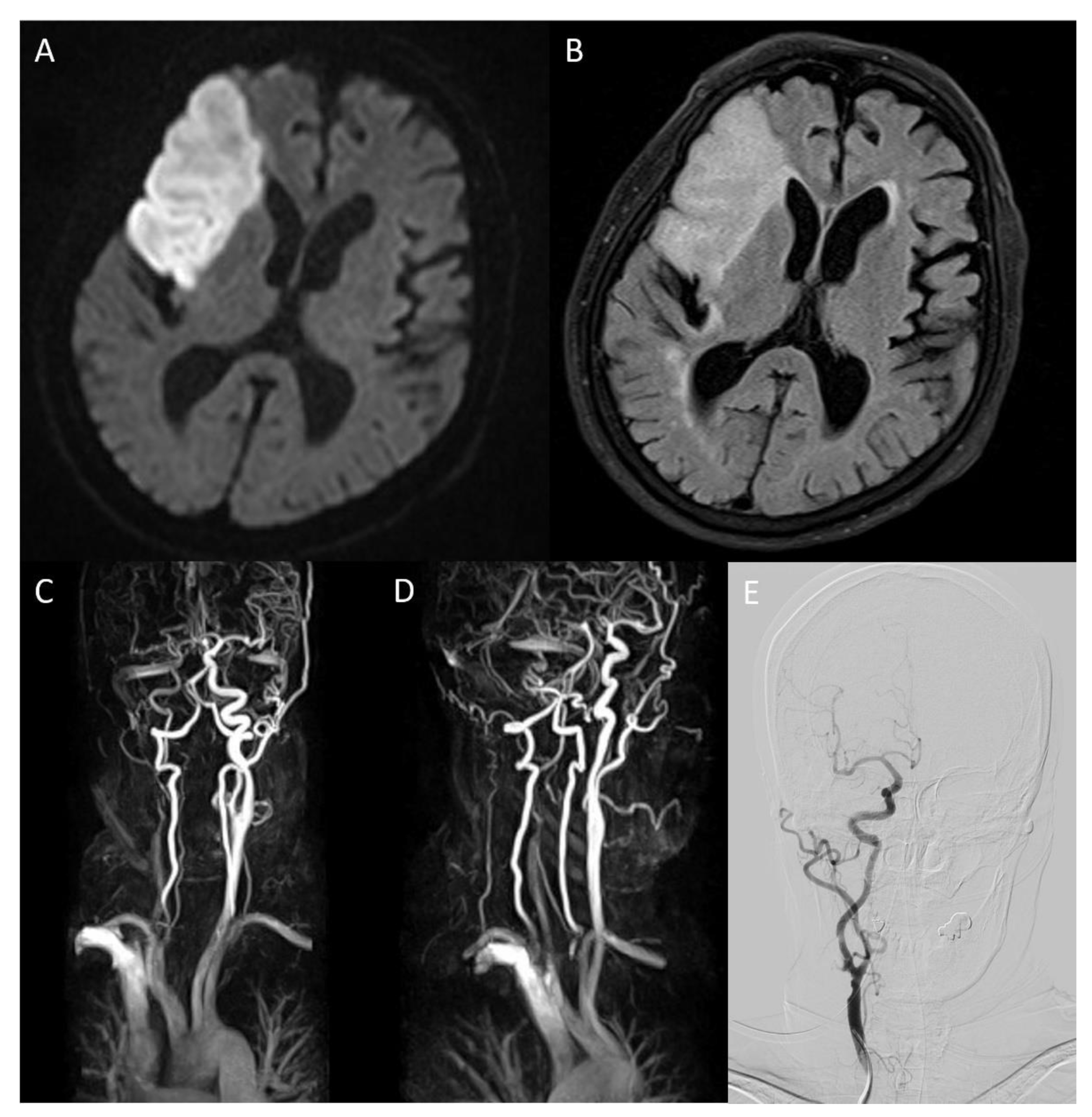 Tomography 08 00044 g001