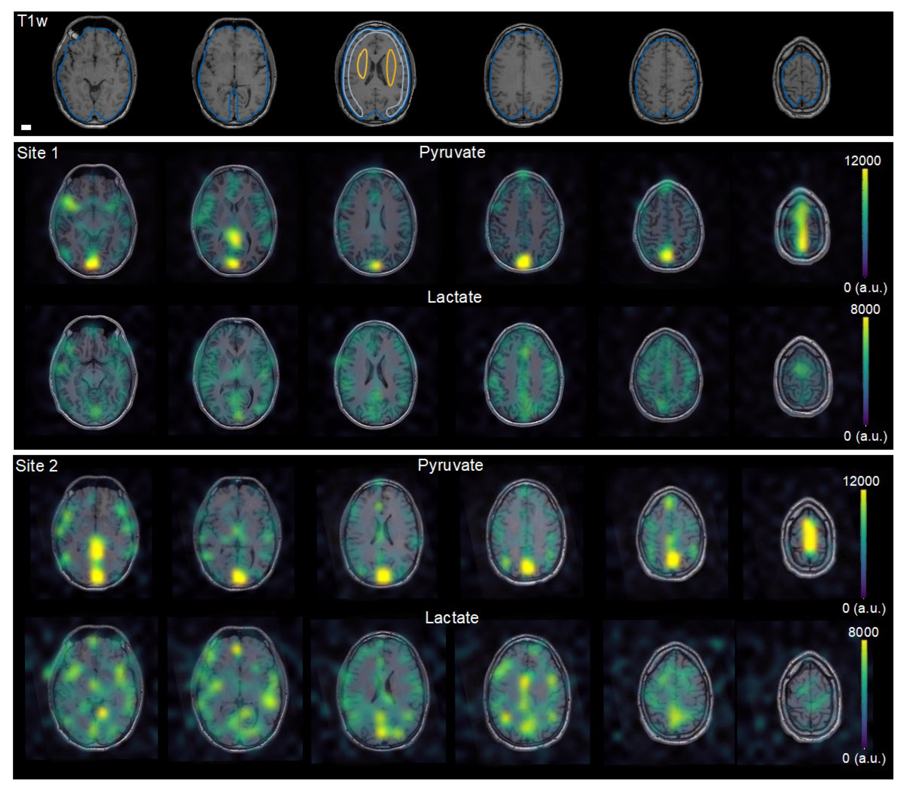 Tomography 08 00048 g002 550