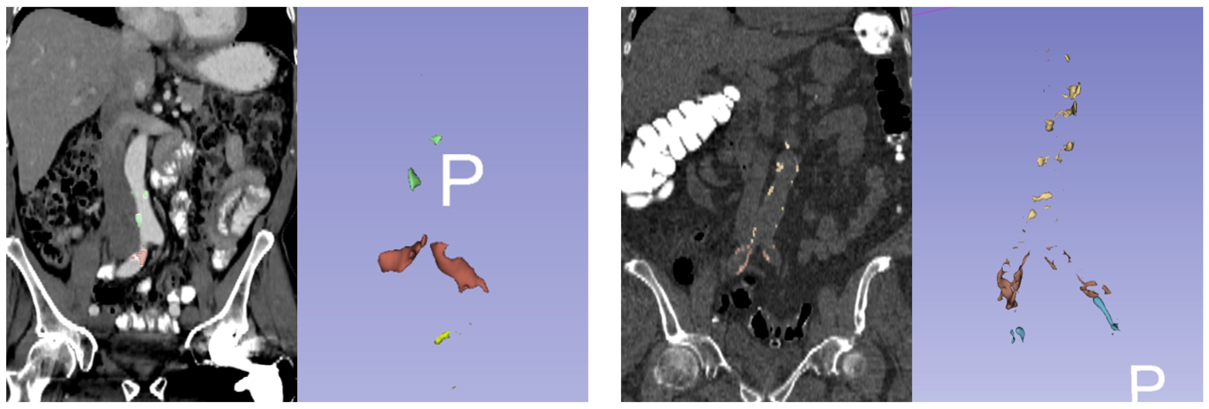 Tomography 08 00050 g002 Tomography 08 00050 g002