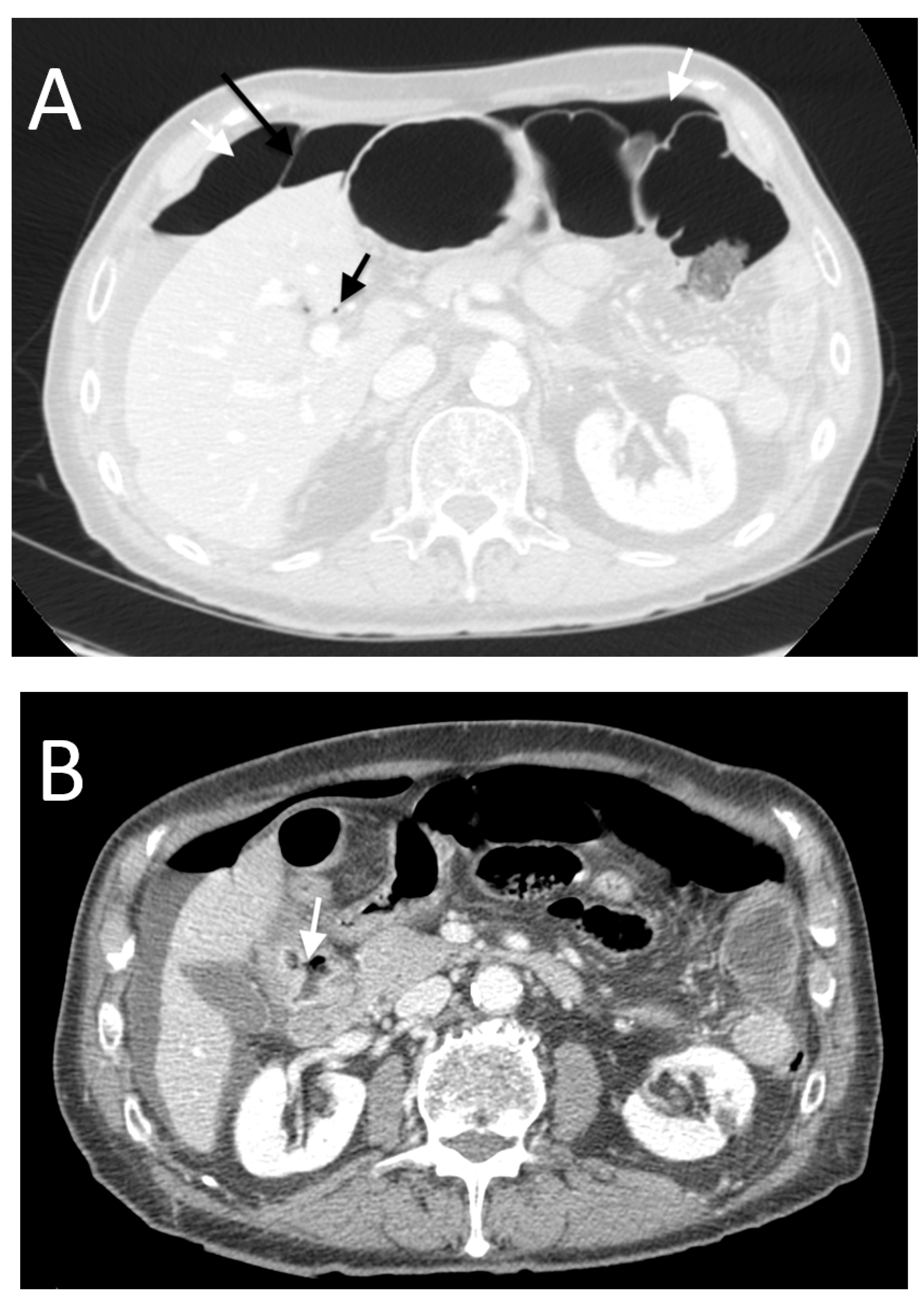 Tomography 08 00056 g004