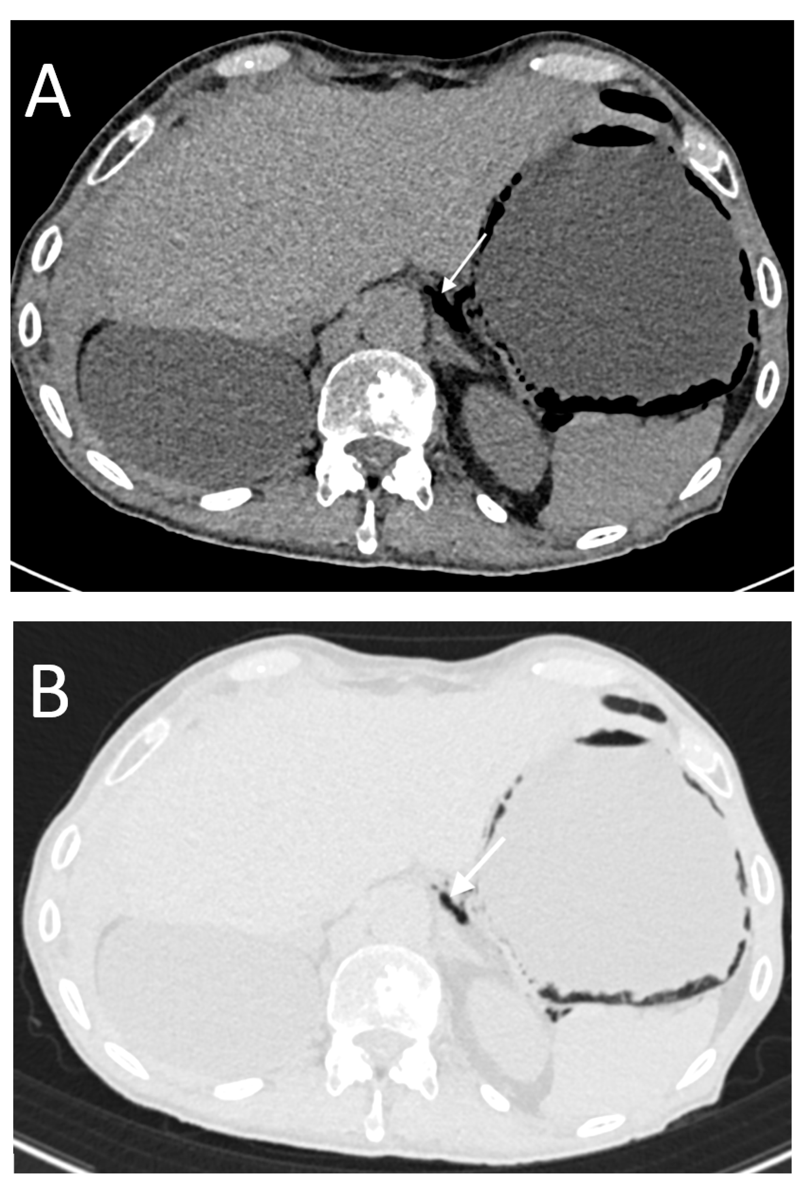 Tomography 08 00056 g005