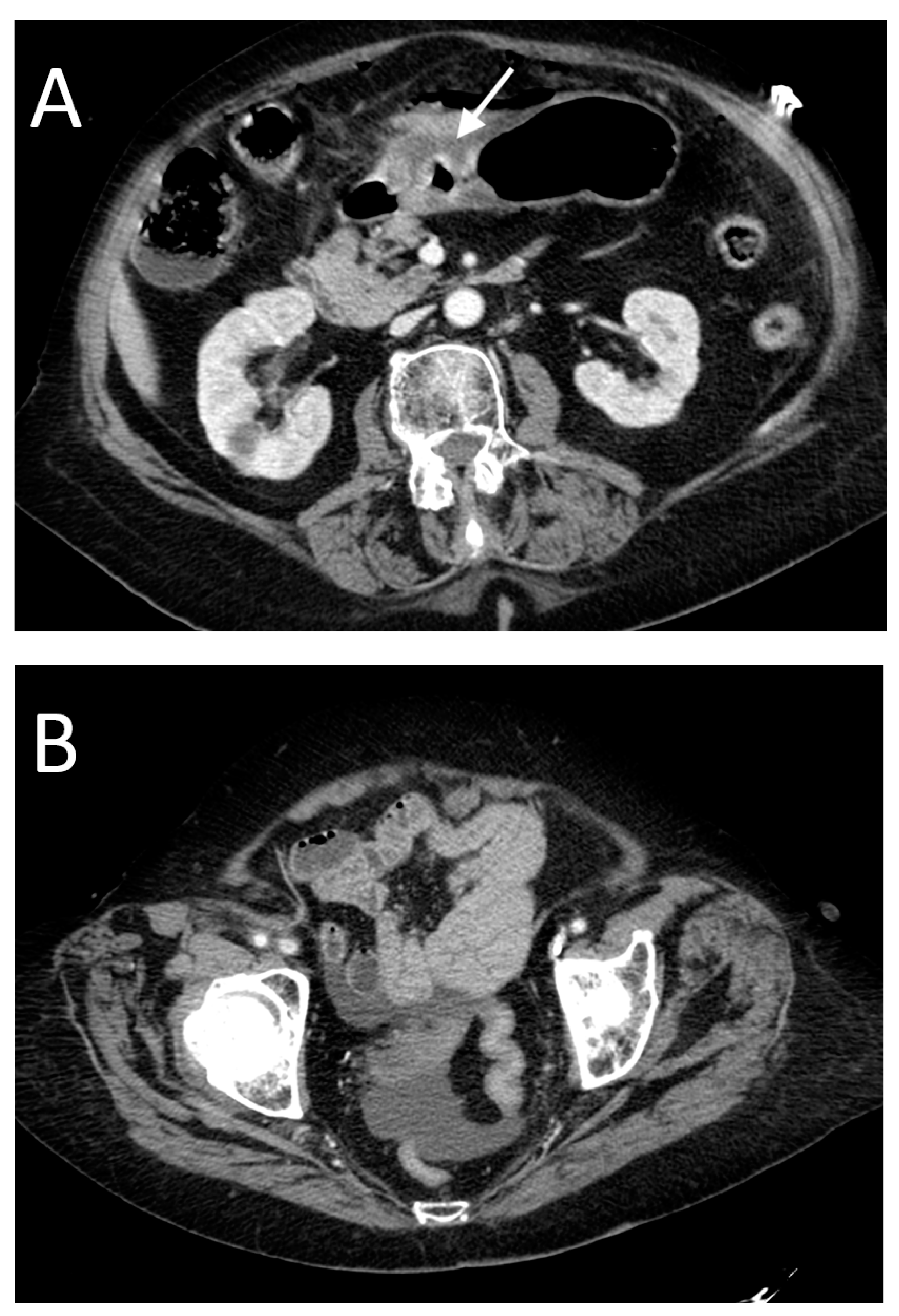 Tomography 08 00056 g006