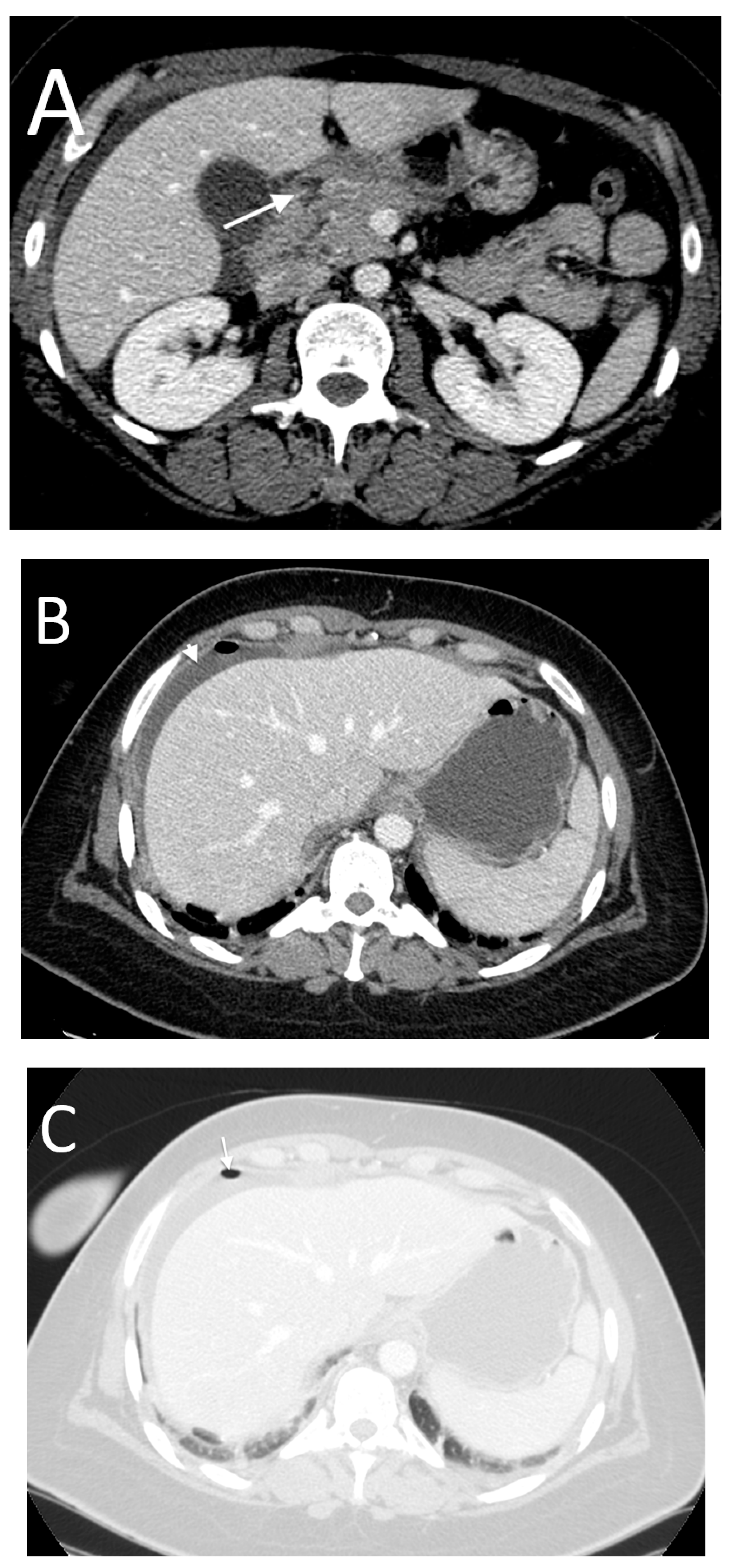 Tomography 08 00056 g007