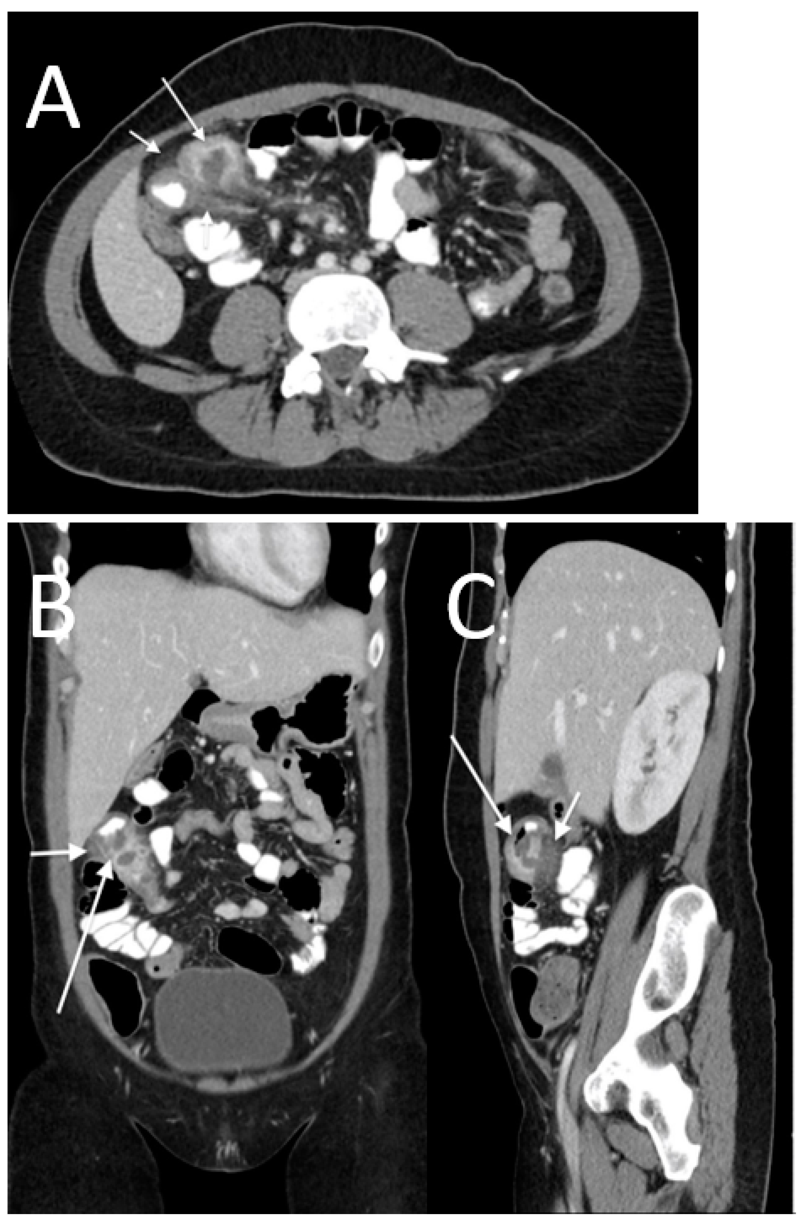 Tomography 08 00056 g009