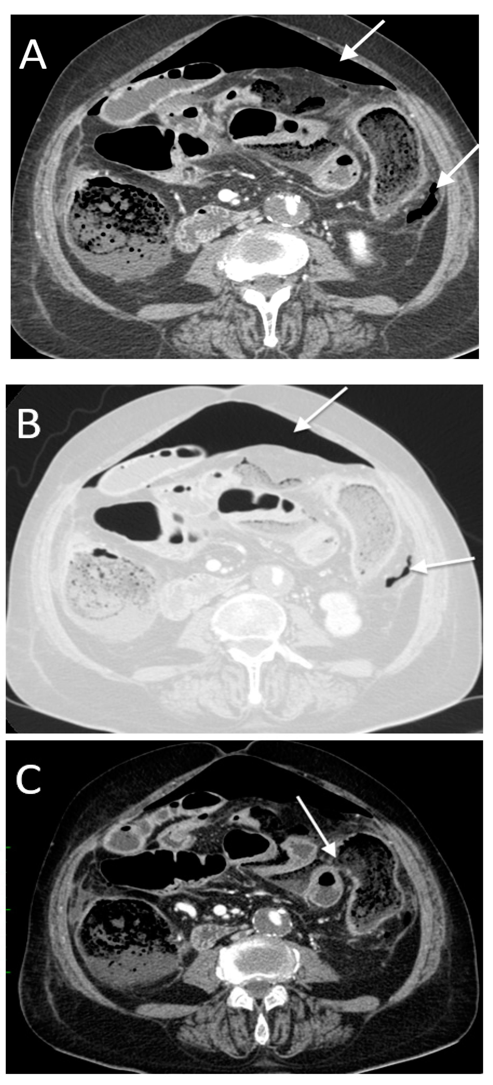 Tomography 08 00056 g010a