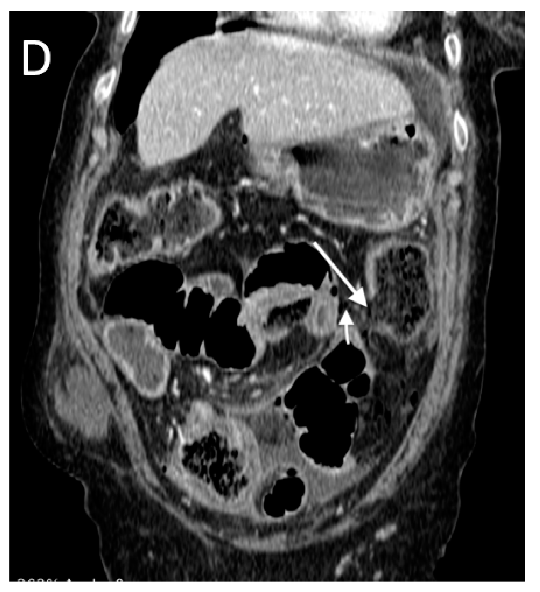 Tomography 08 00056 g010b