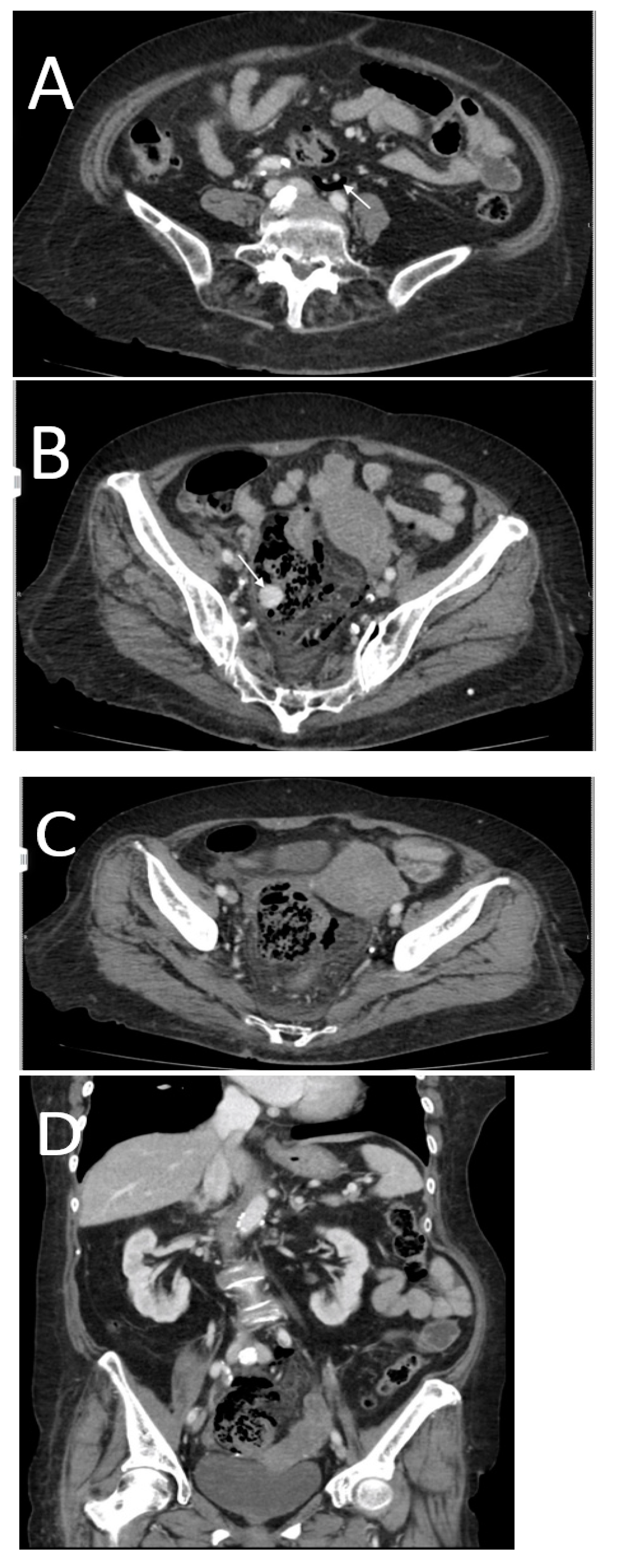 Tomography 08 00056 g011a