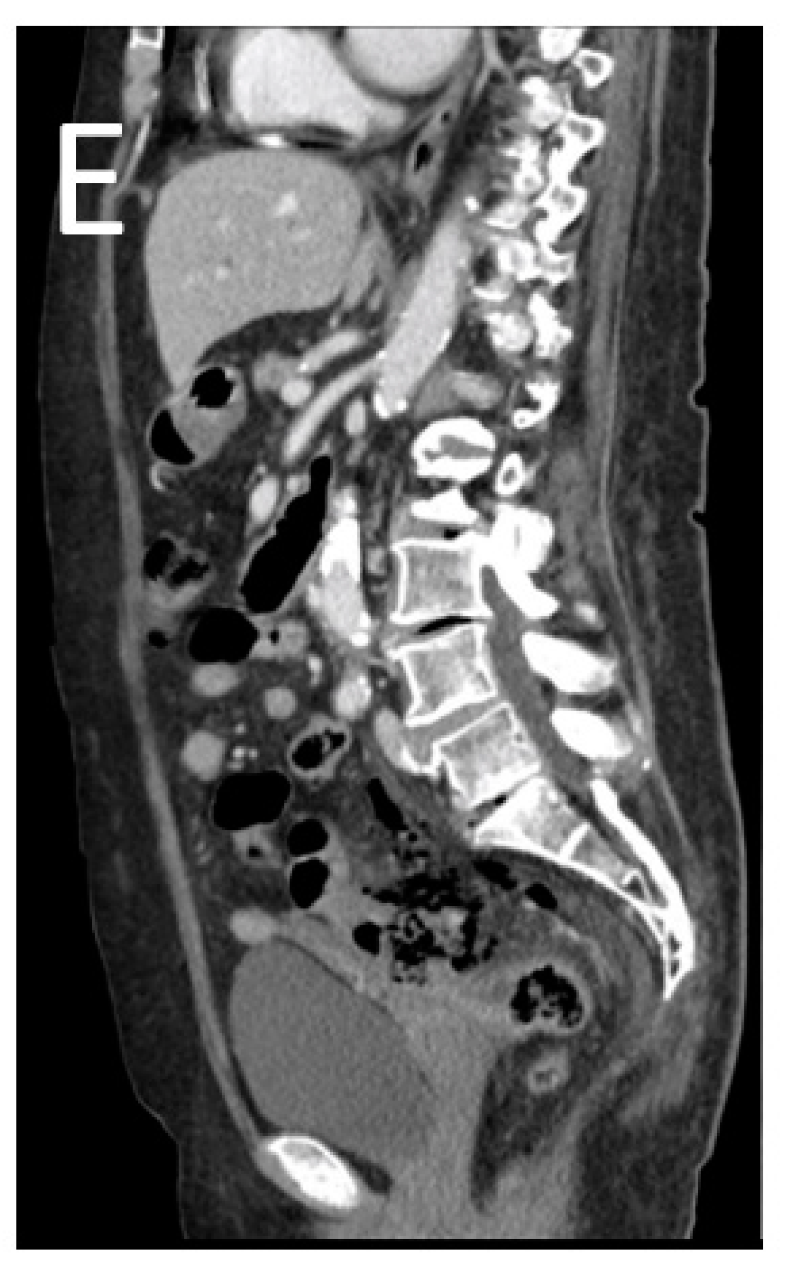 Tomography 08 00056 g011b