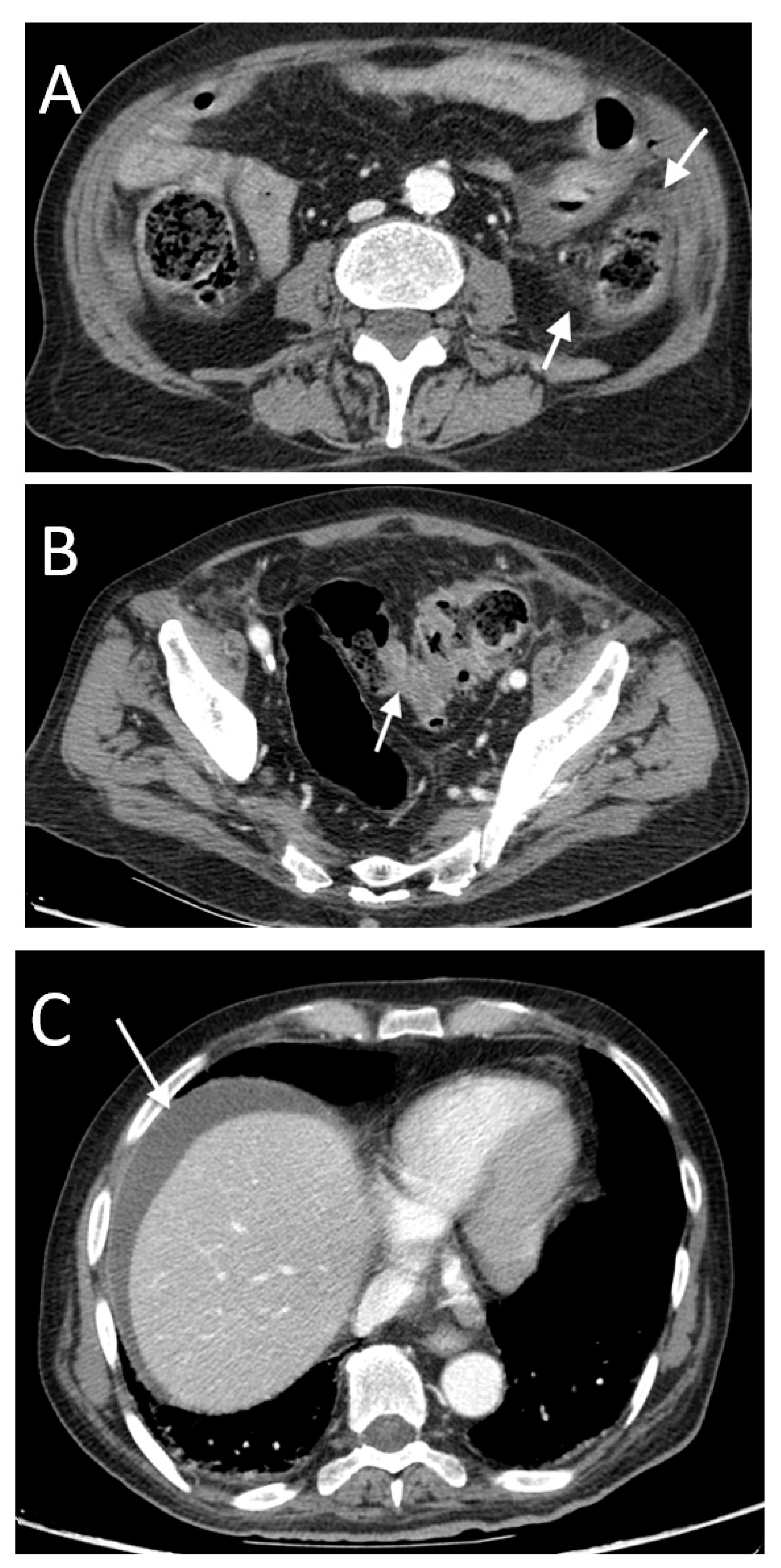 Tomography 08 00056 g012