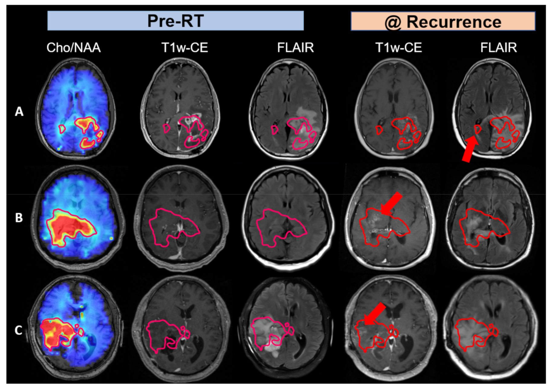 Tomography 08 00057 g004