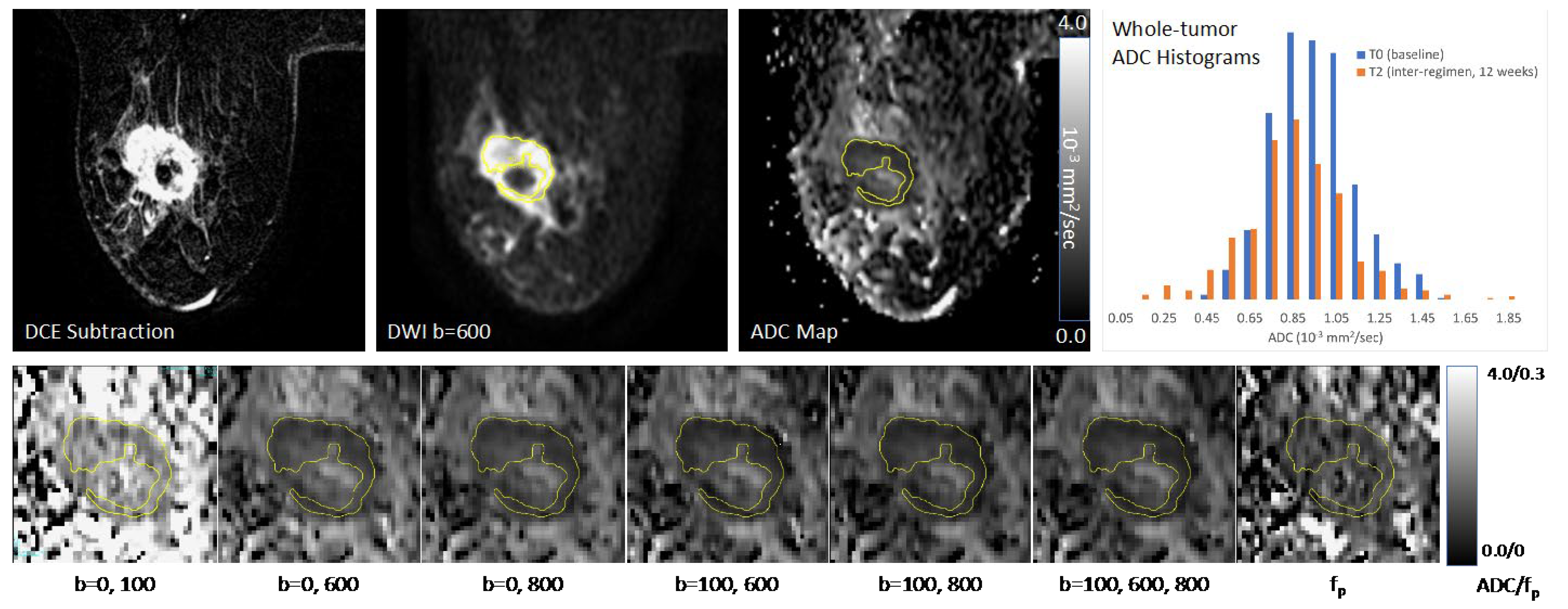 Tomography 08 00058 g003 550