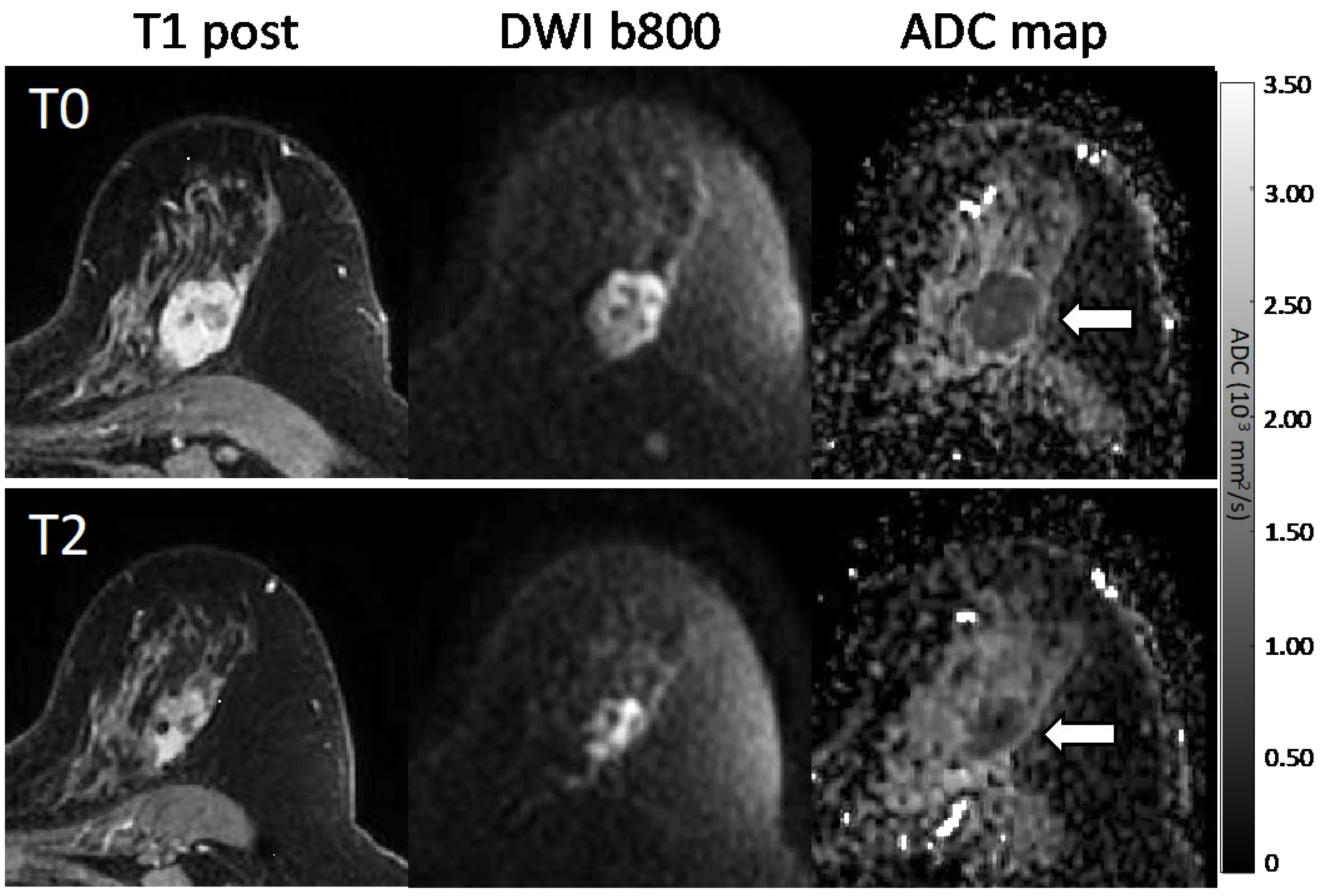 Tomography 08 00058 g005 550