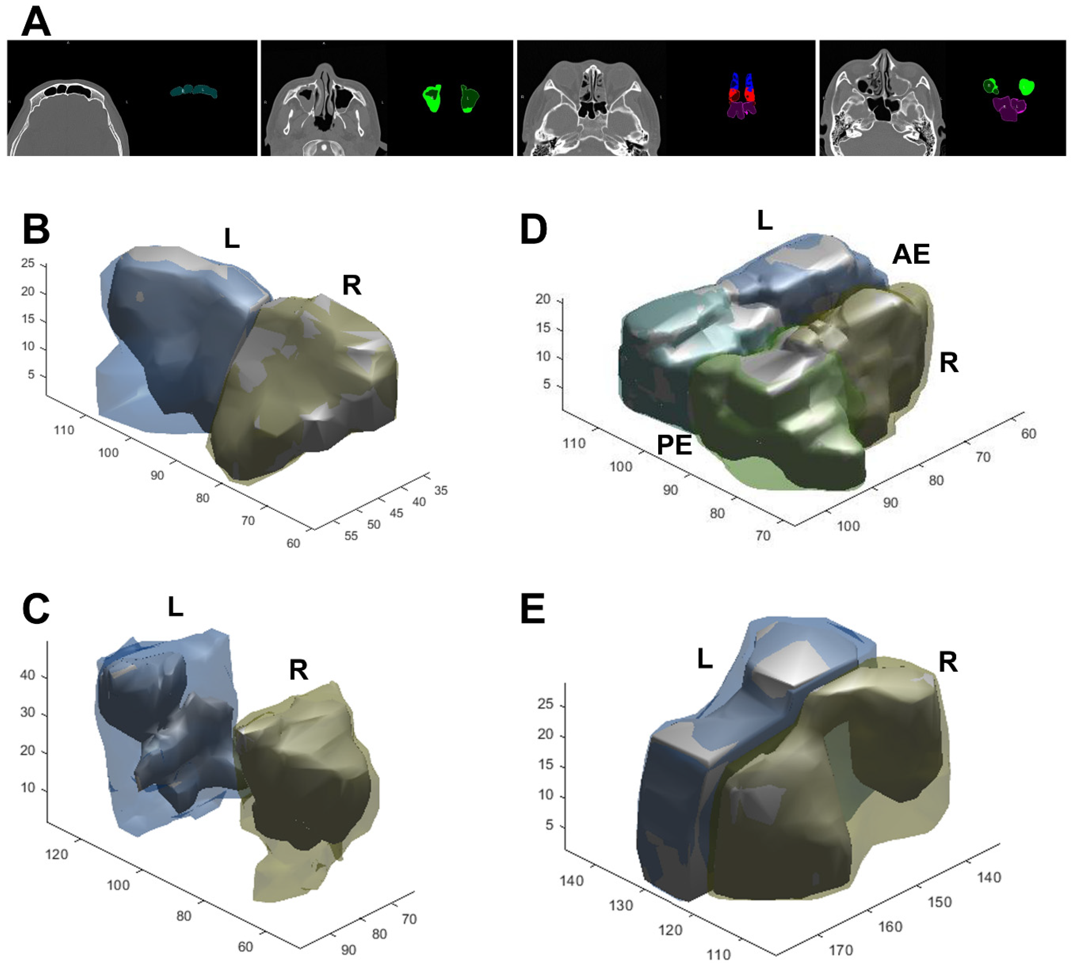 Tomography 08 00059 g004
