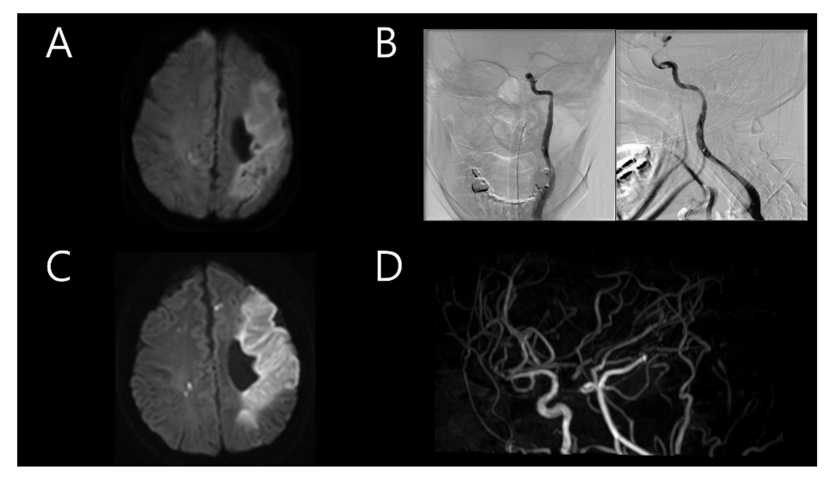 Tomography 08 00062 g001 550