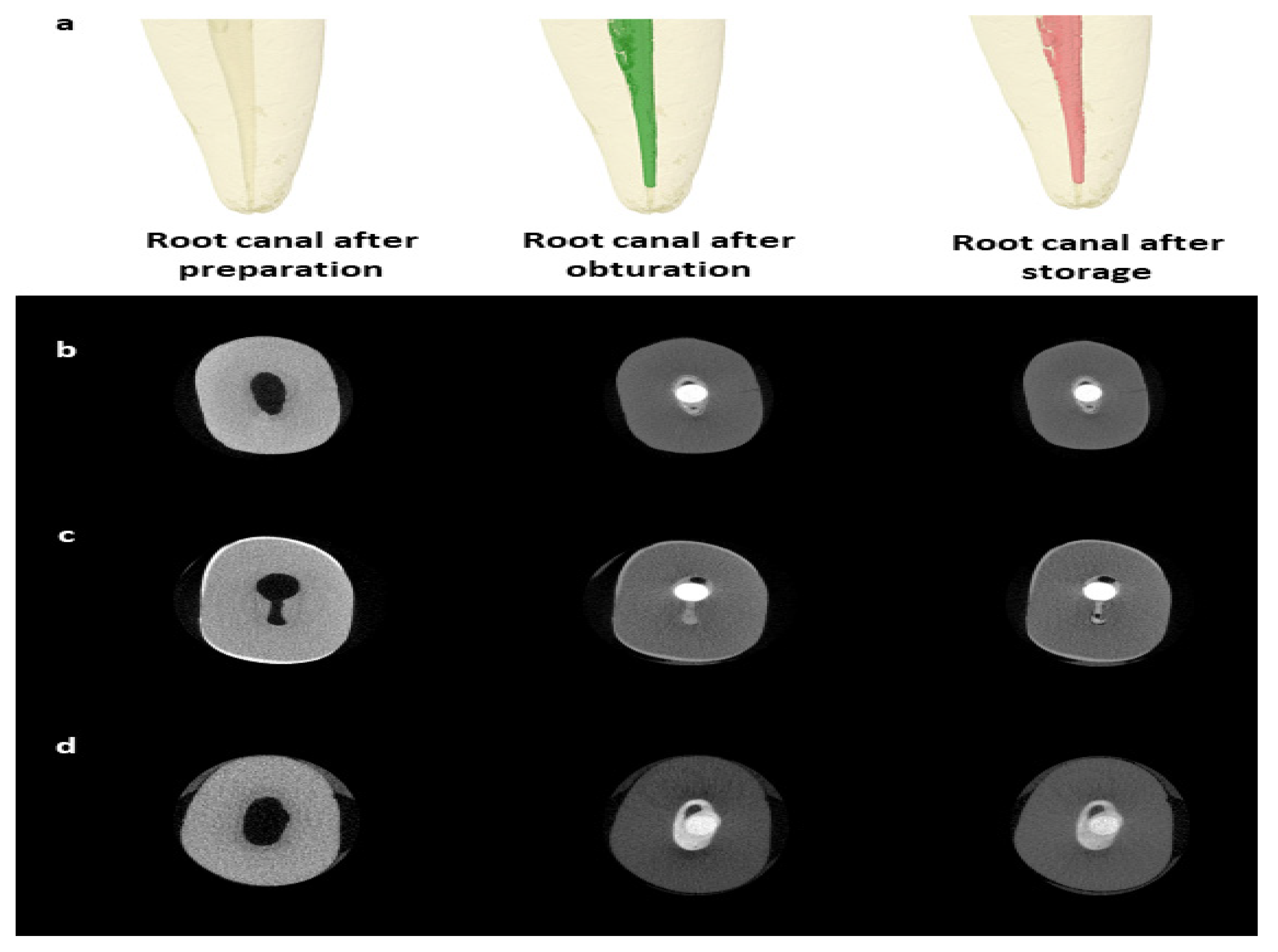 Tomography 08 00064 g001 Tomography 08 00064 g001