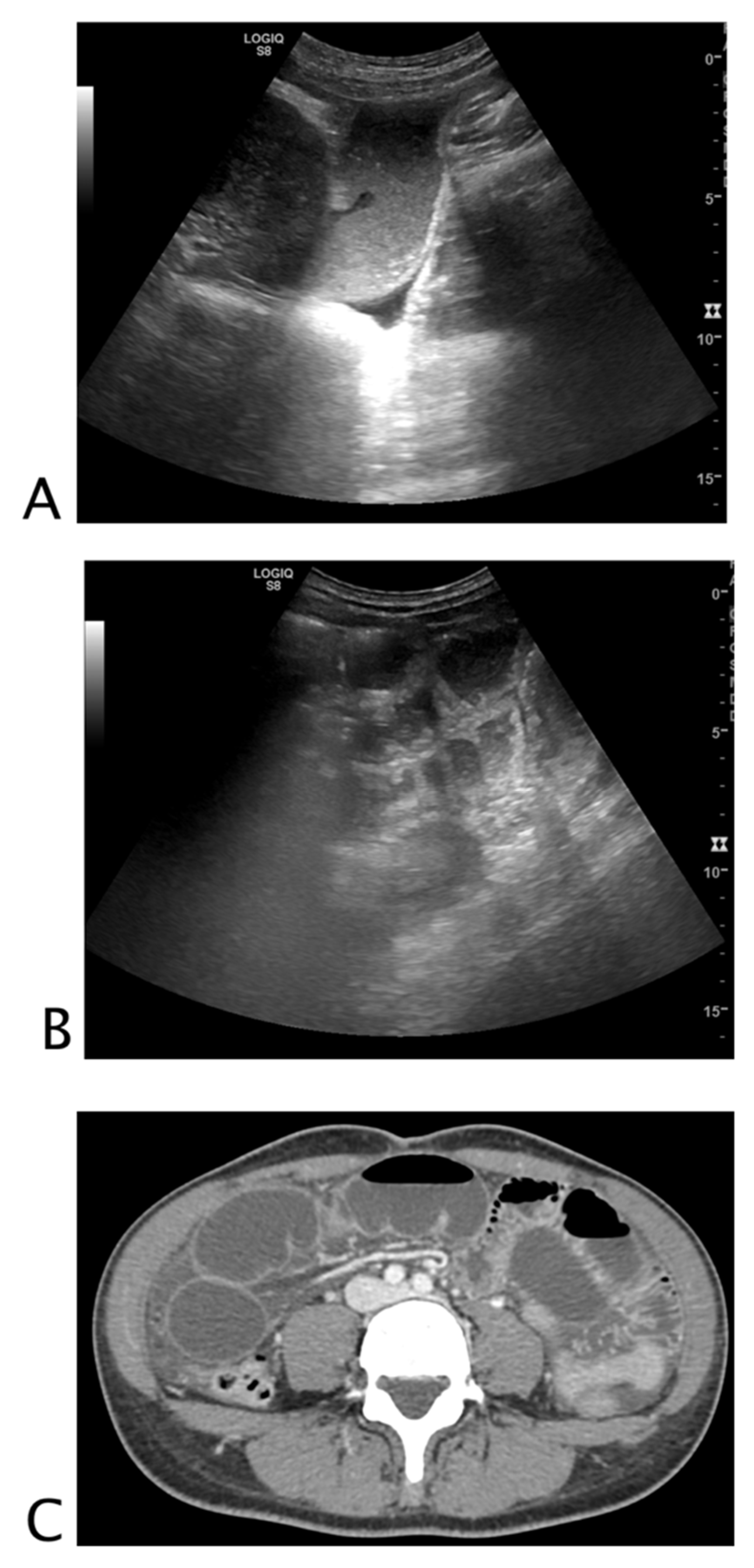 Tomography 08 00066 g005