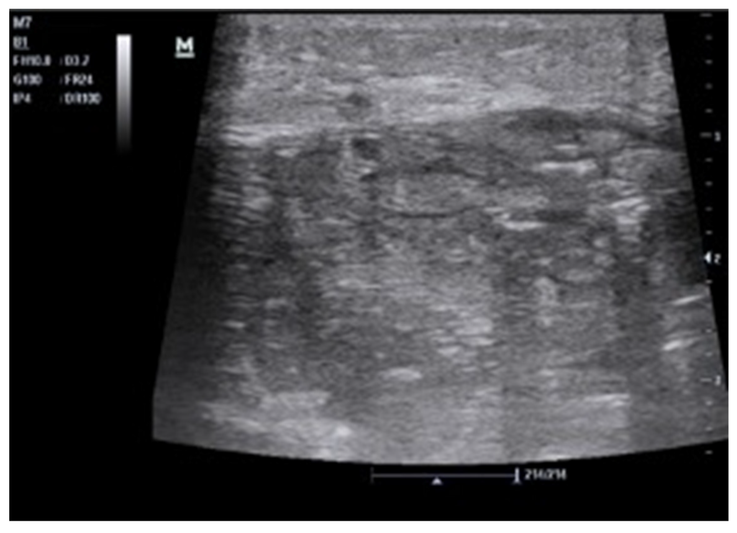 Tomography 08 00066 g008