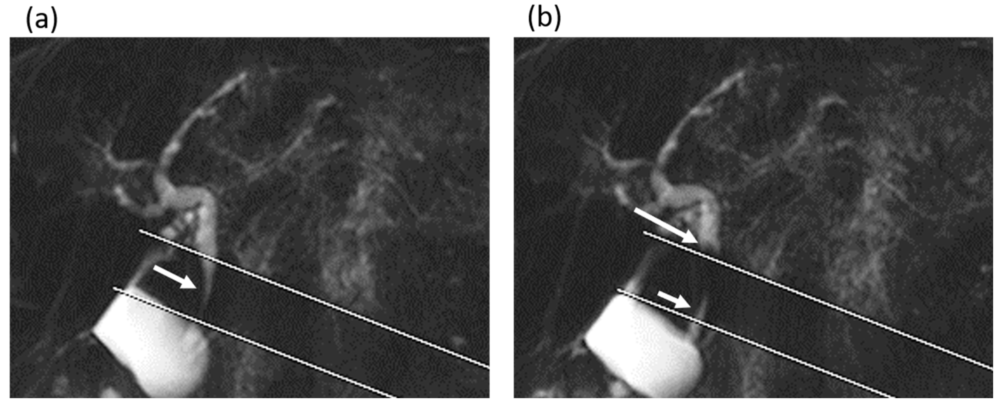 Tomography 08 00067 g004