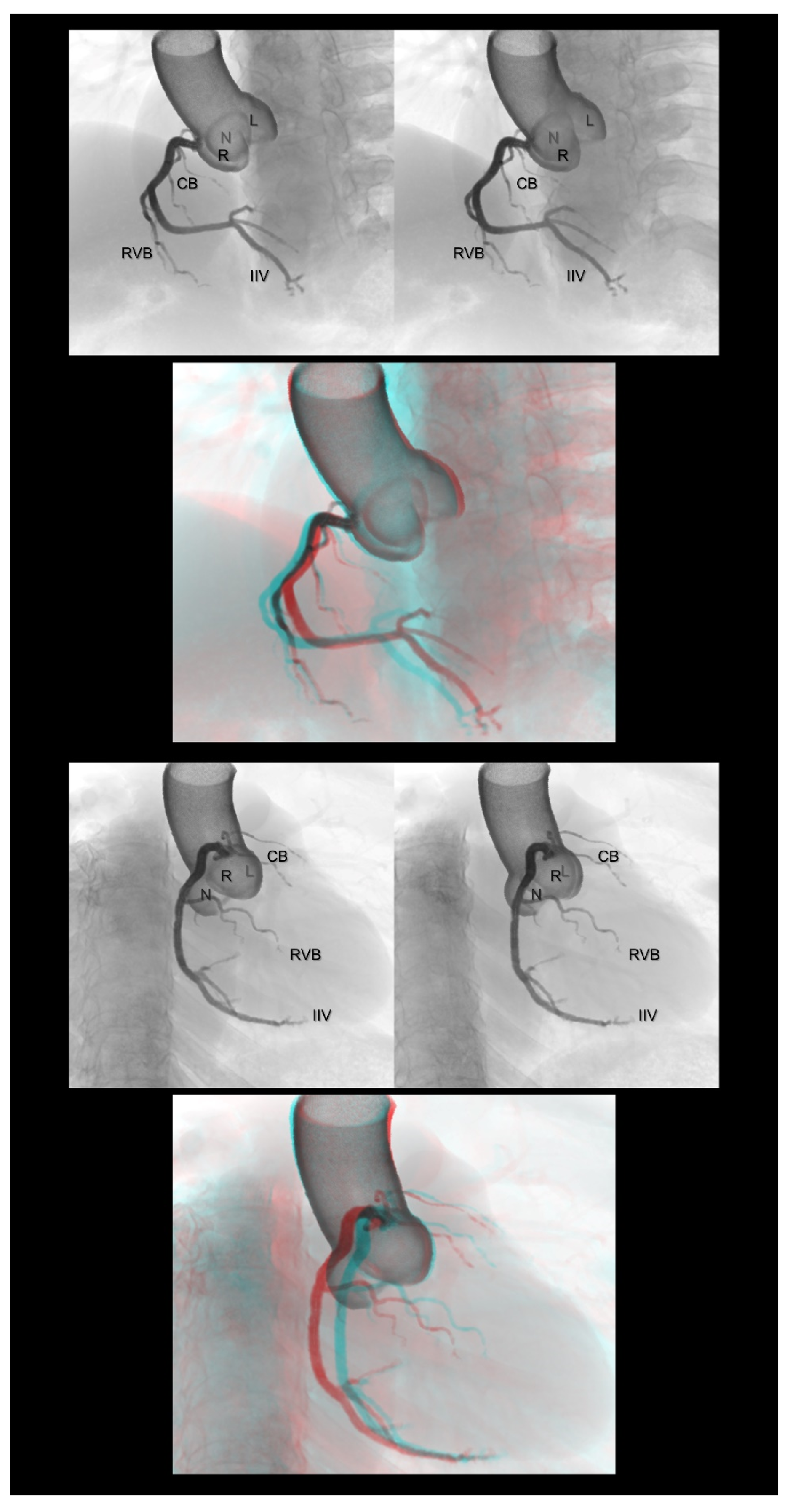 Tomography 08 00068 g002
