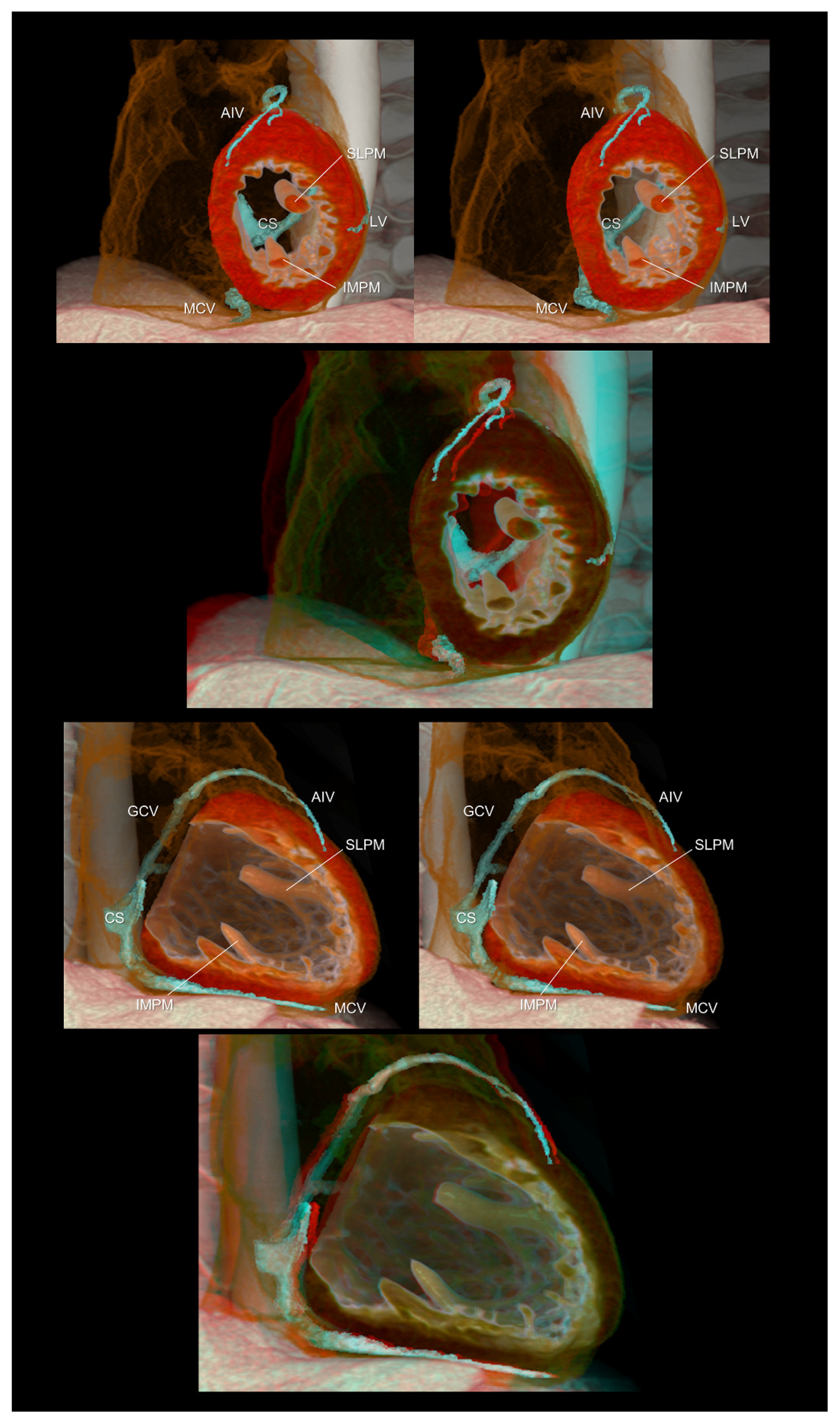 Tomography 08 00068 g004