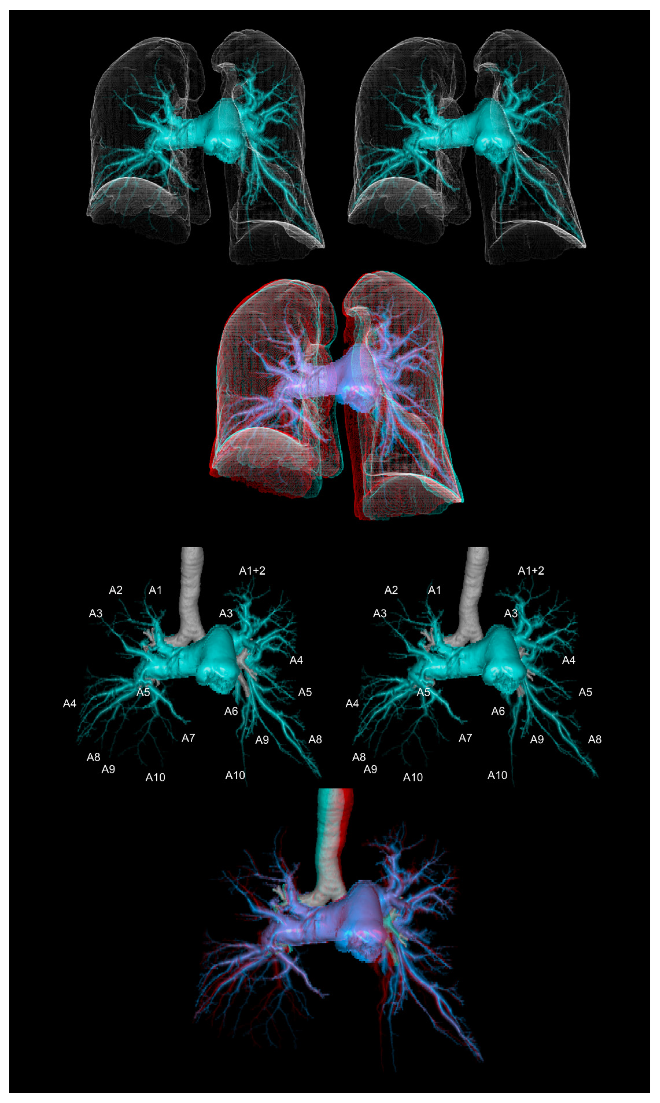 Tomography 08 00068 g005