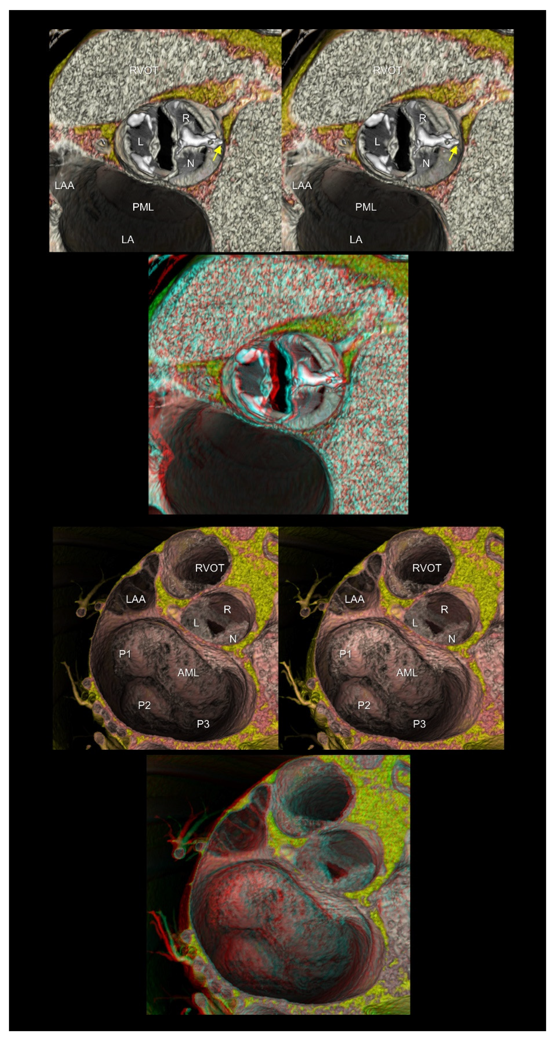 Tomography 08 00068 g006