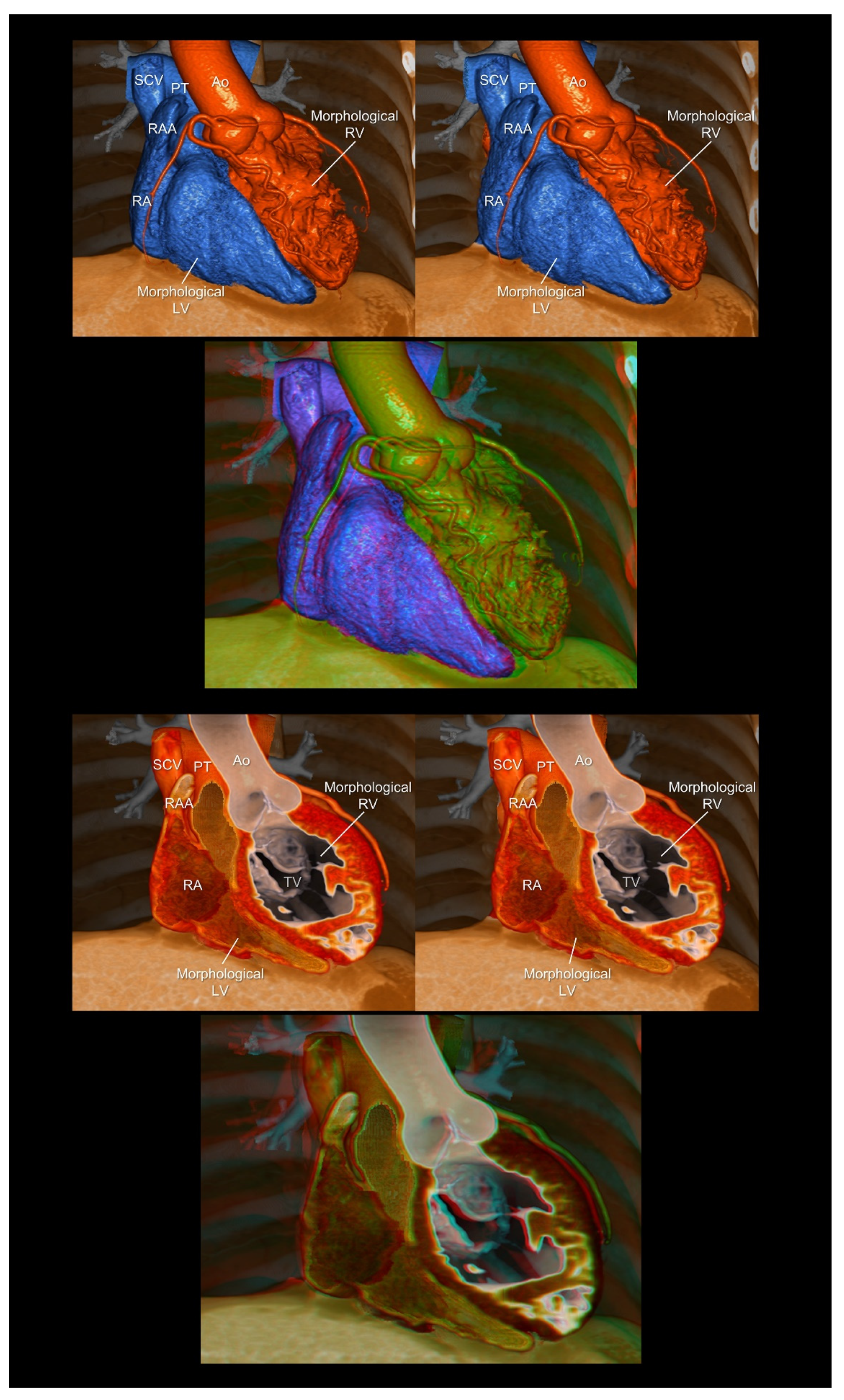 Tomography 08 00068 g007