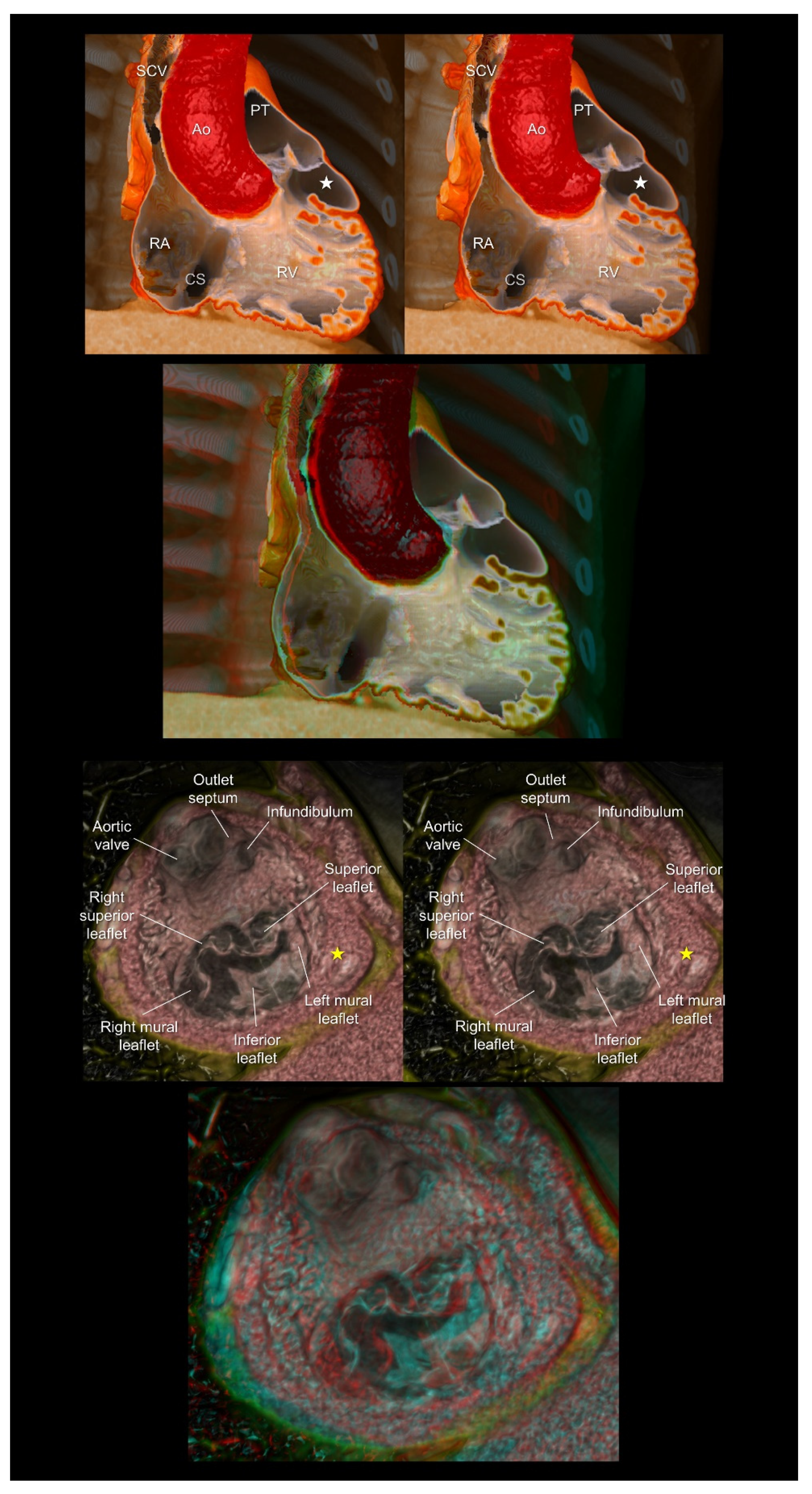 Tomography 08 00068 g008