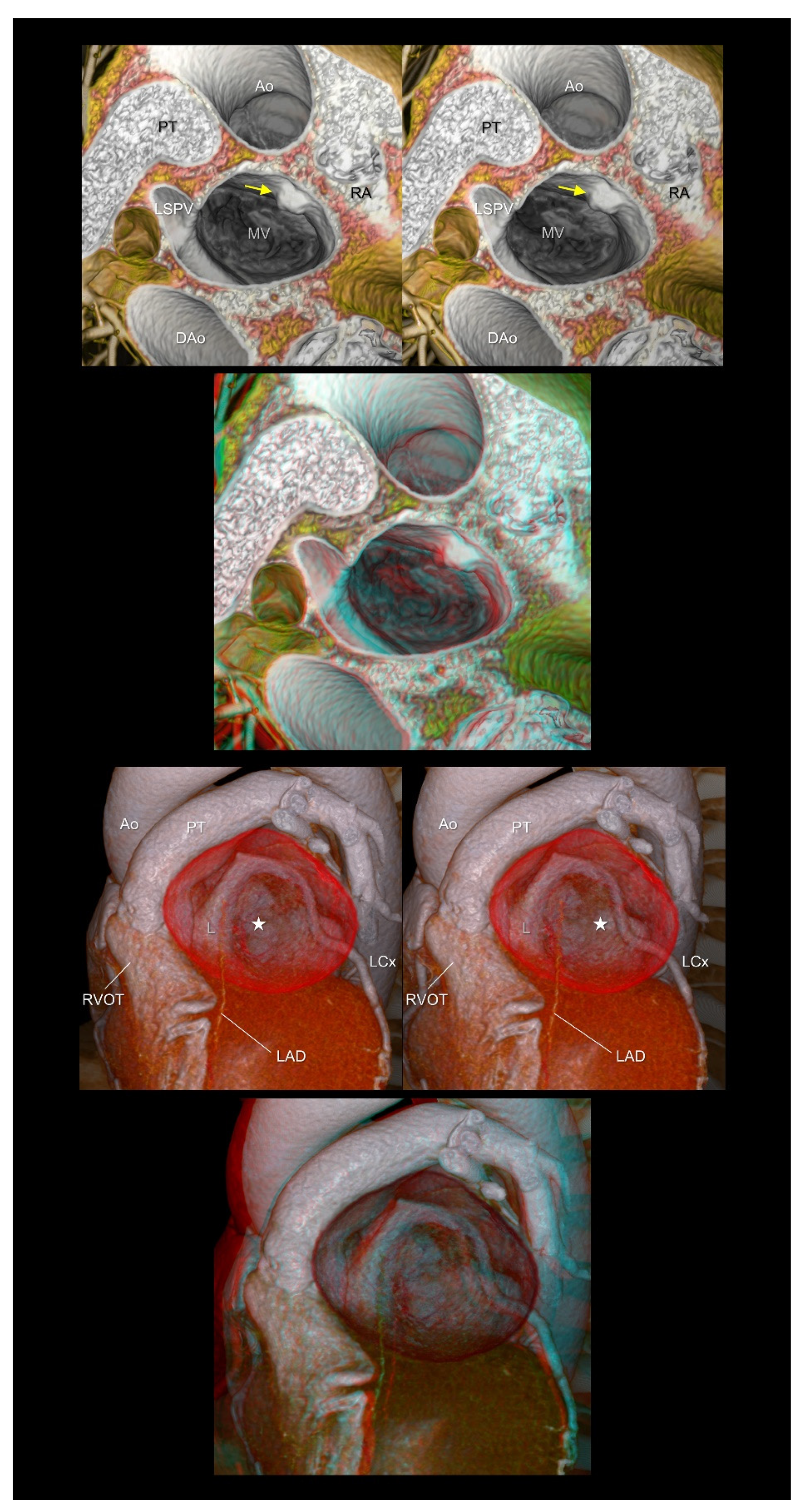 Tomography 08 00068 g009