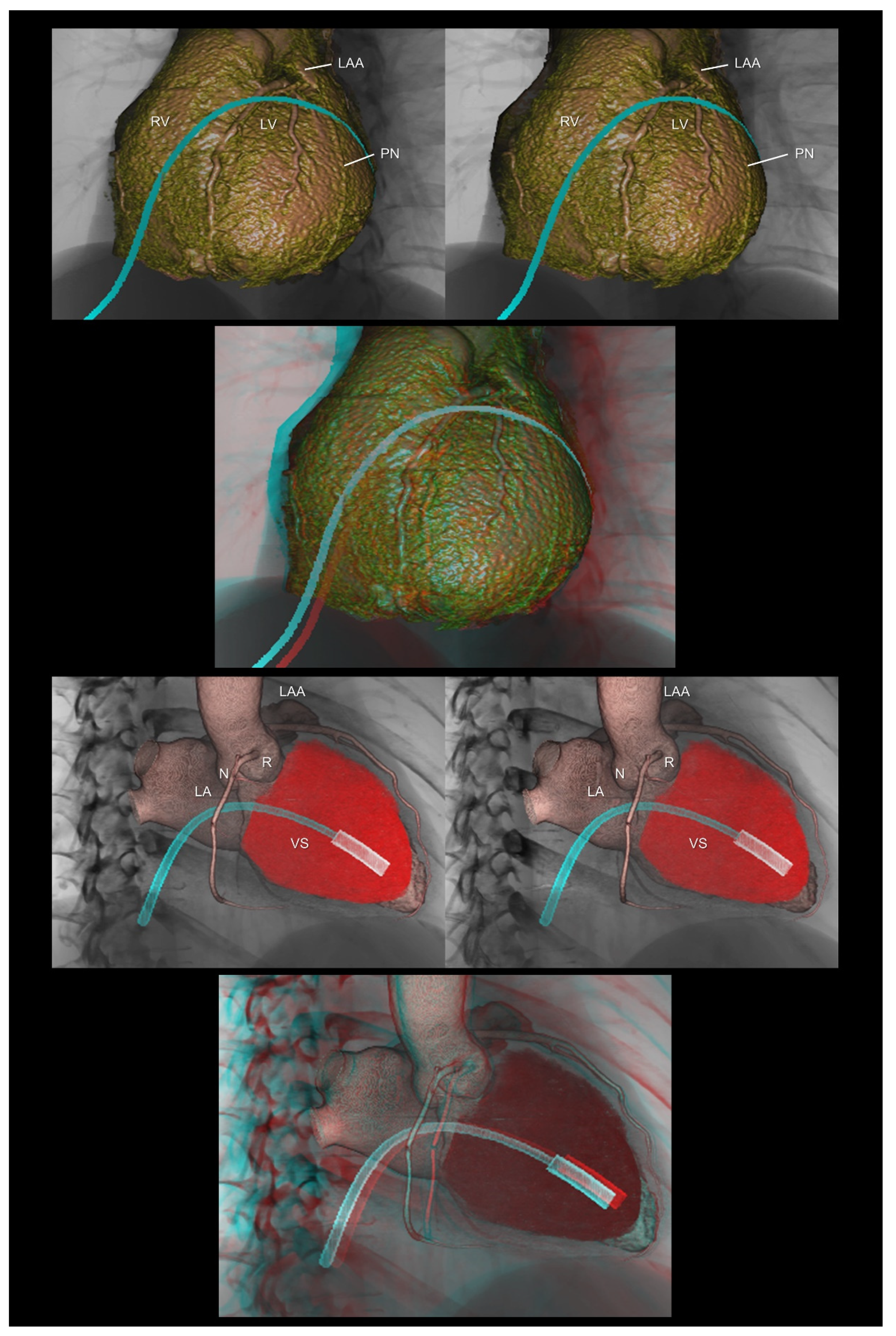 Tomography 08 00068 g010
