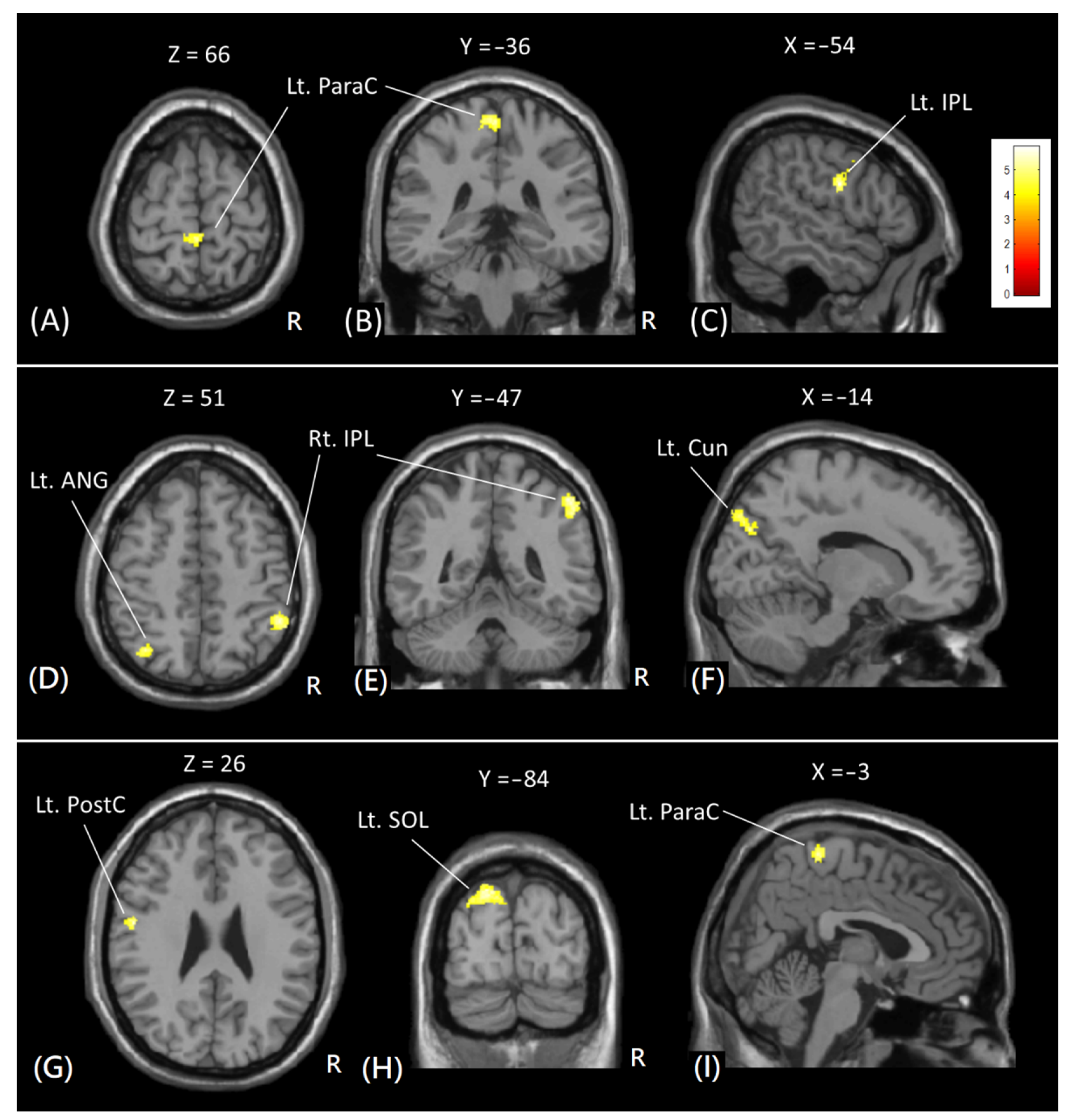 Tomography 08 00070 g004 550