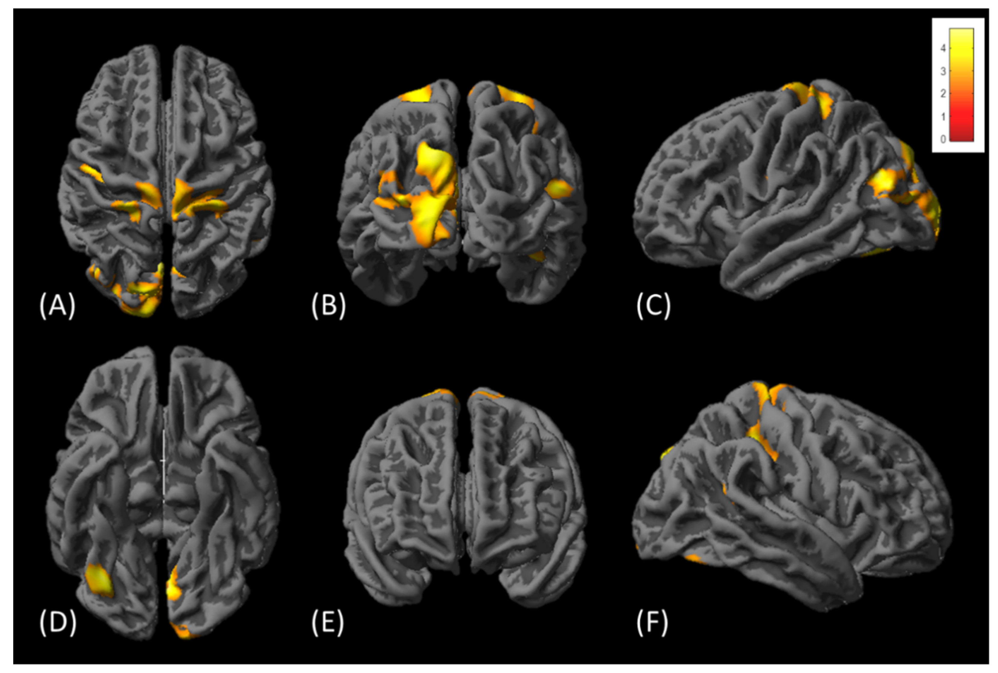 Tomography 08 00070 g005 550