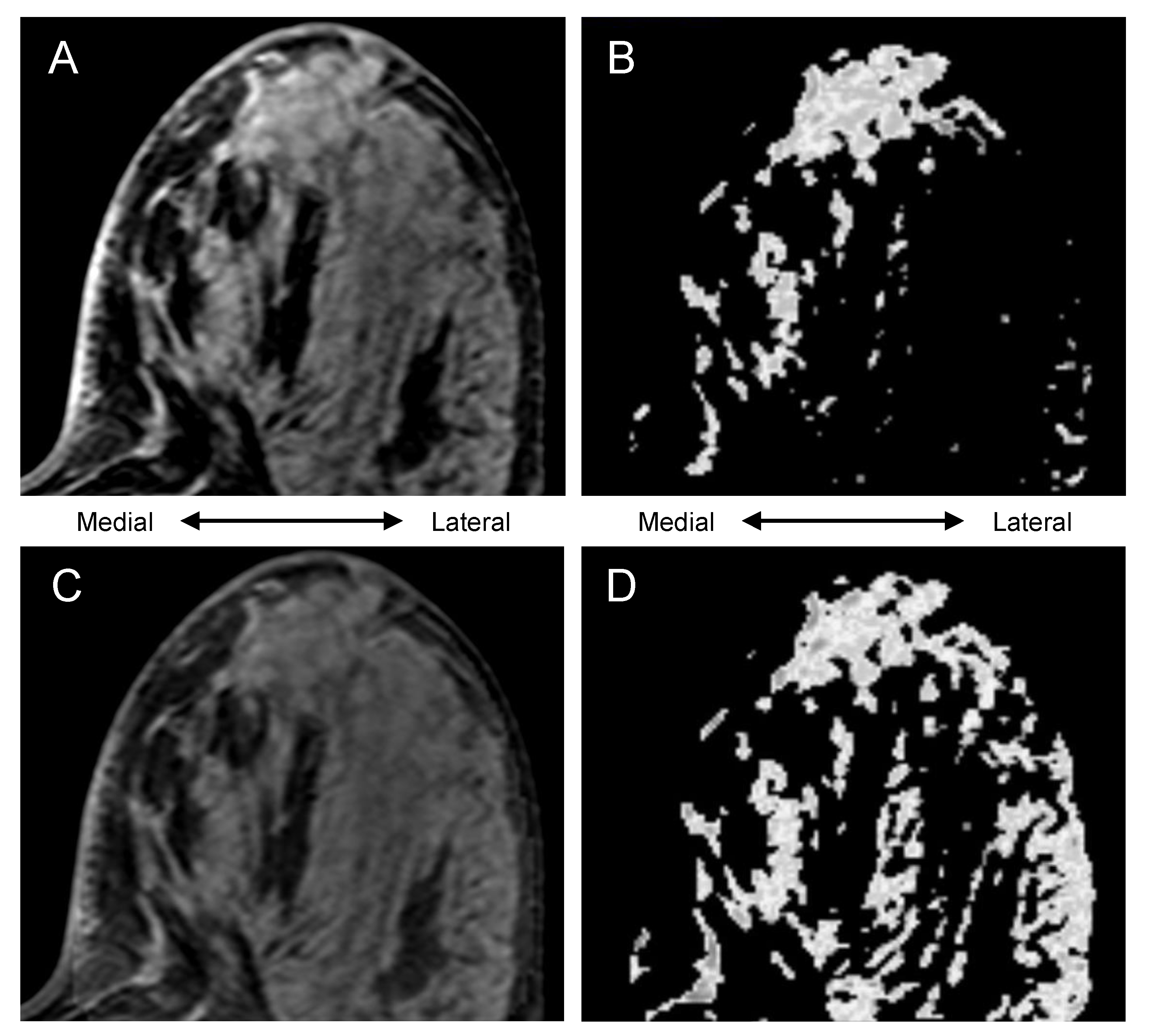 Tomography 08 00072 g004