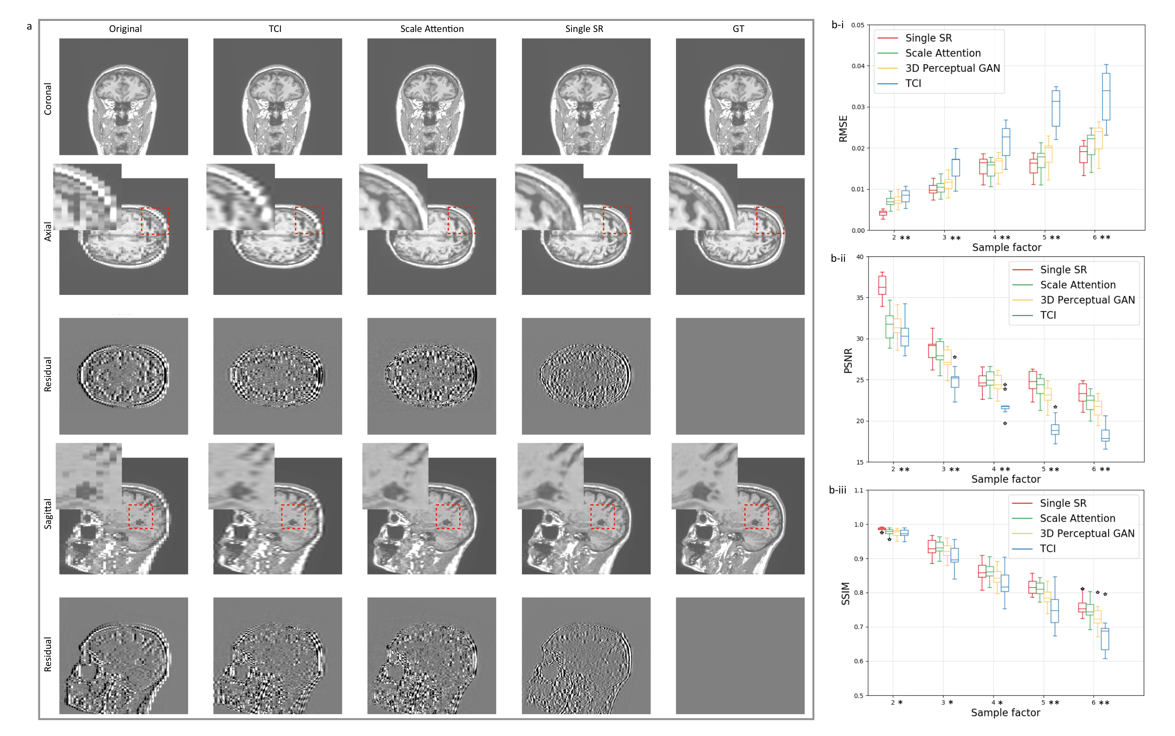 Tomography 08 00073 g002 550