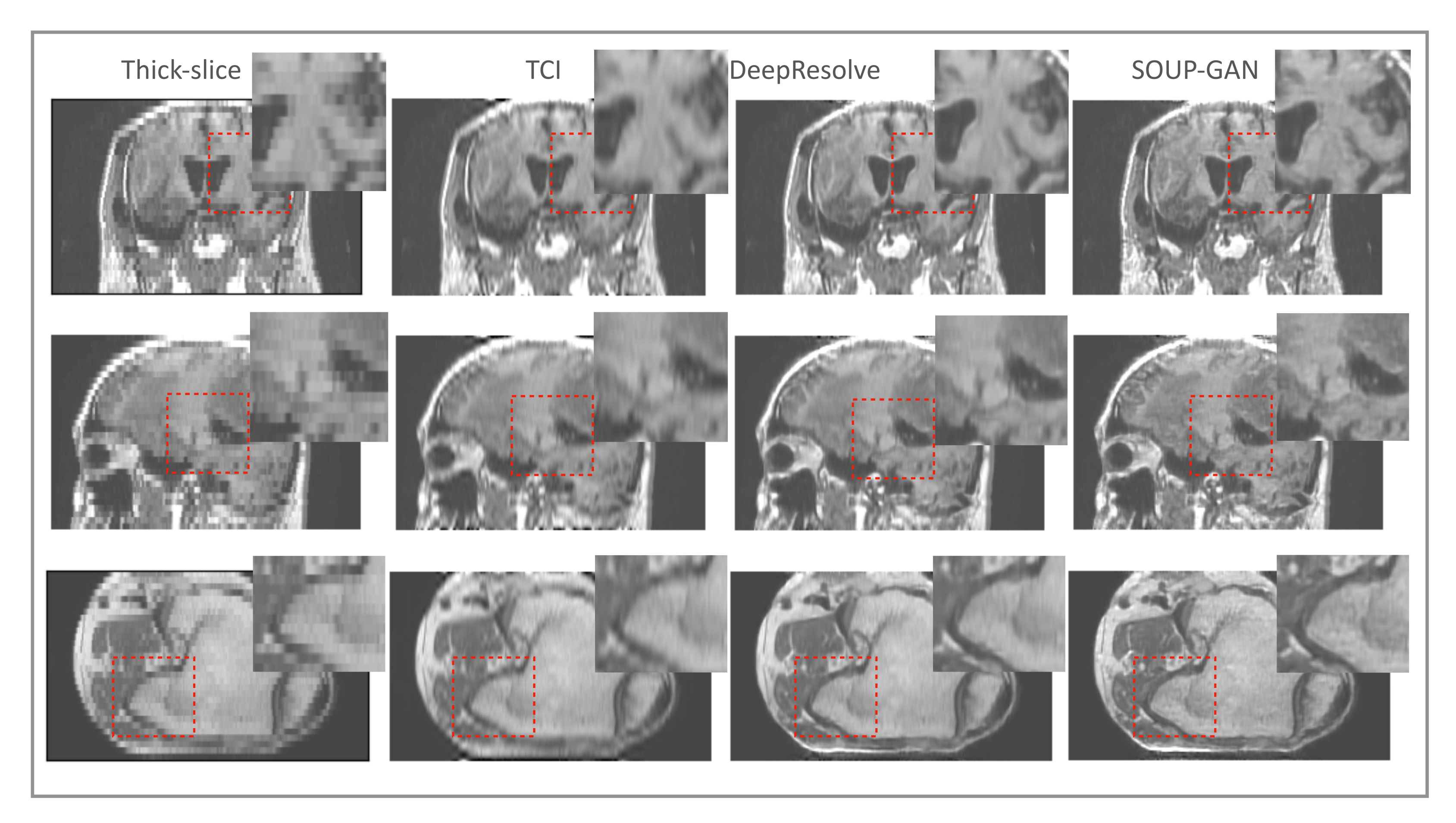 Tomography 08 00073 g008 550