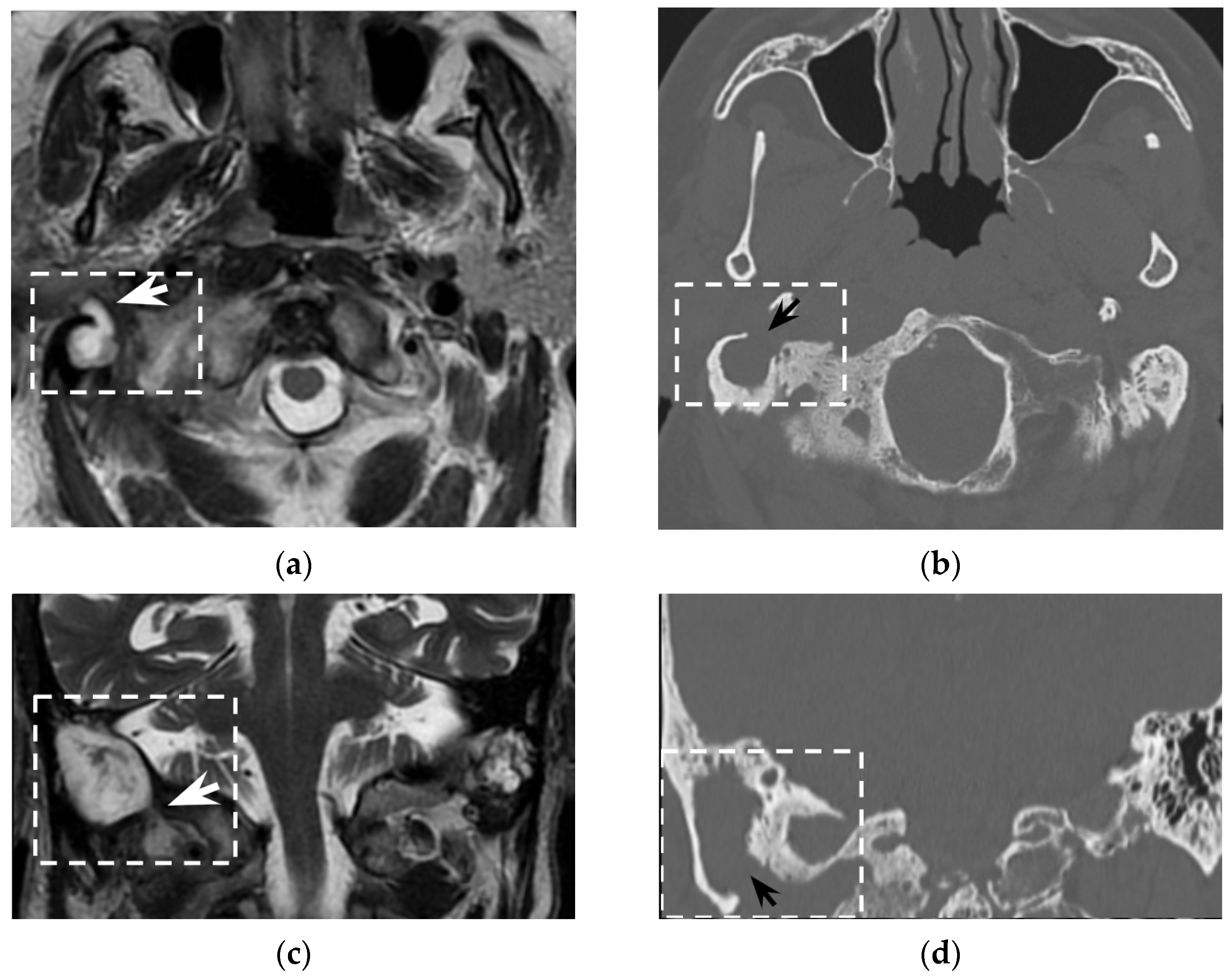Tomography 08 00074 g004