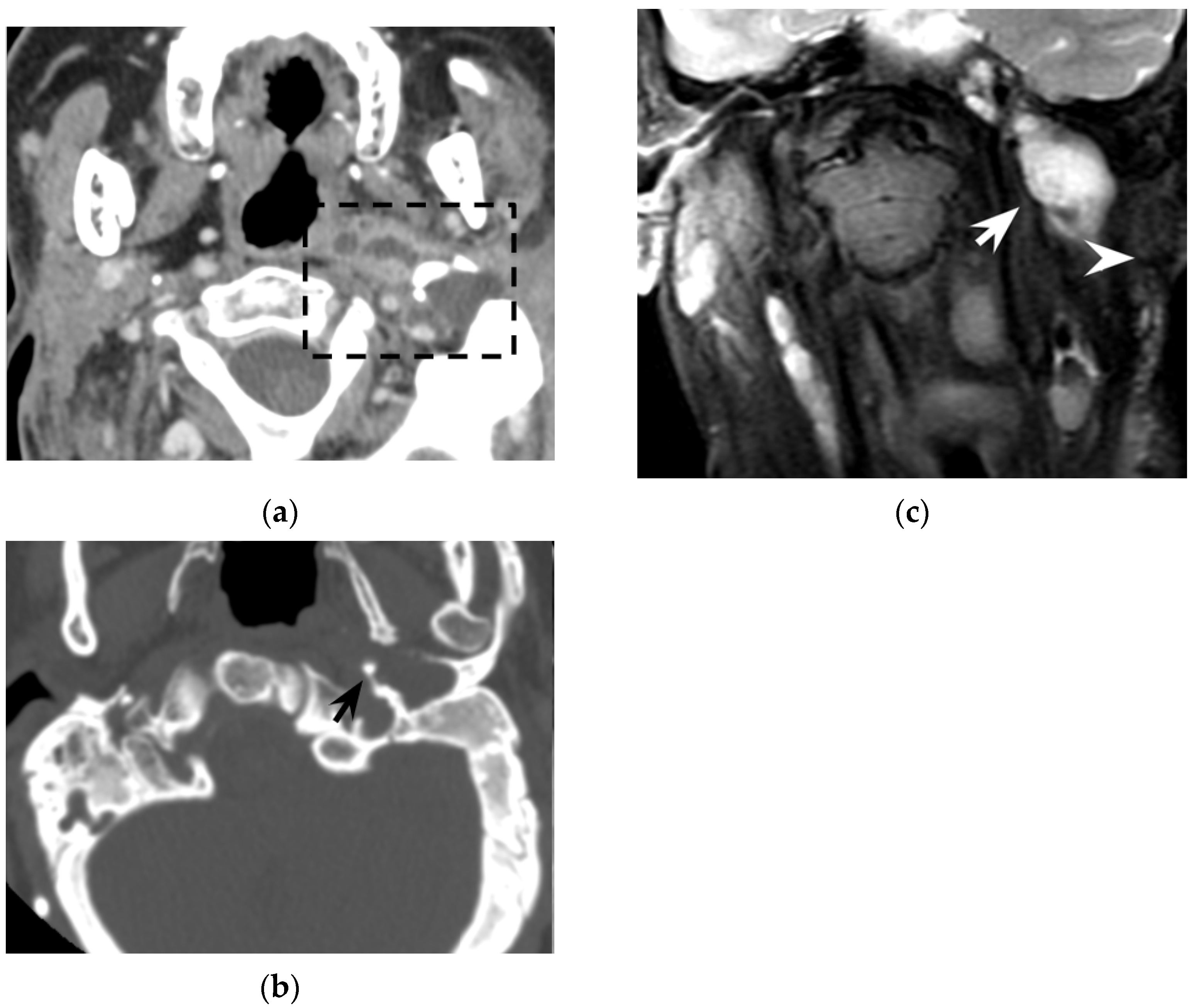 Tomography 08 00074 g005