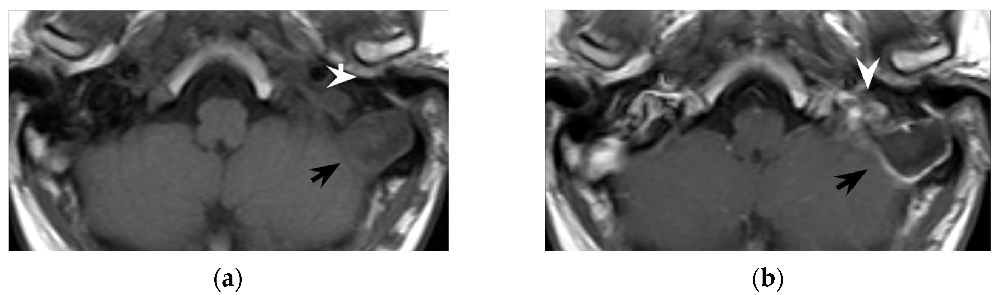 Tomography 08 00074 g006a