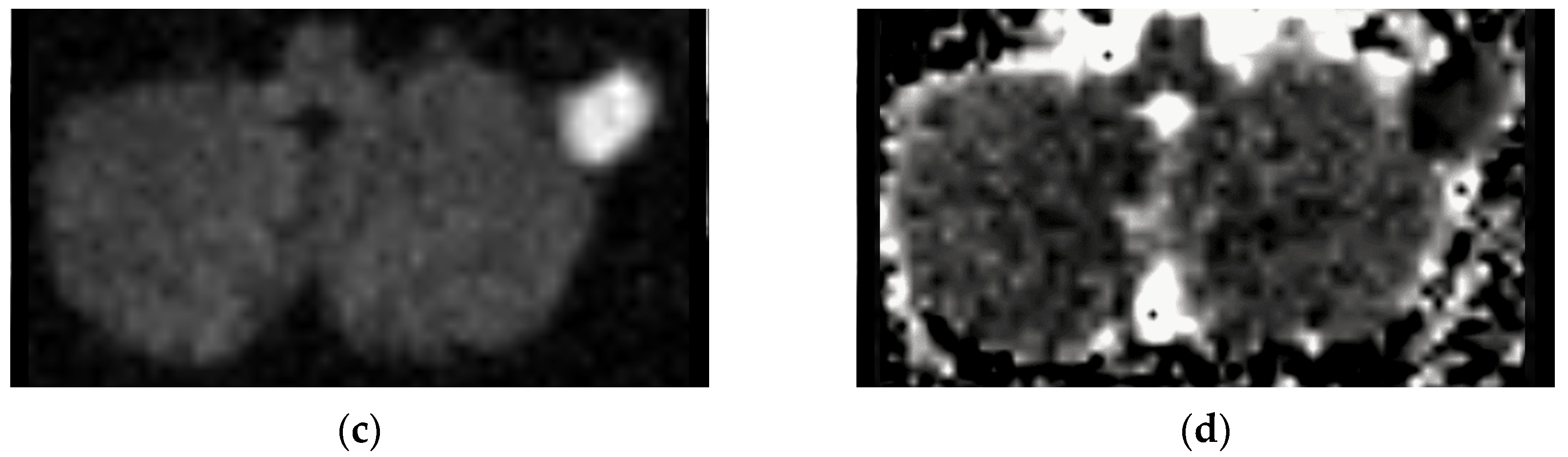 Tomography 08 00074 g006b