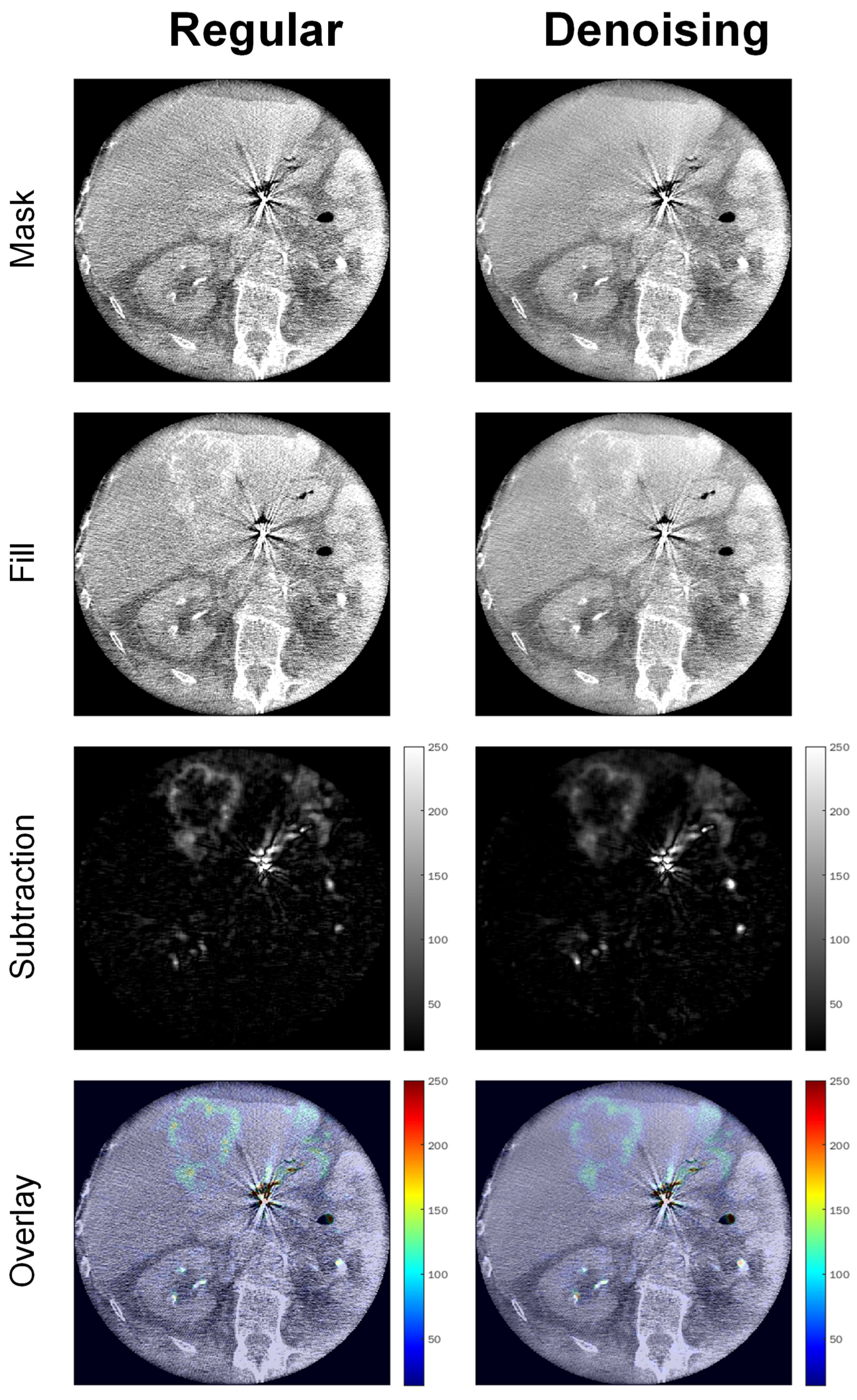 Tomography 08 00075 g007