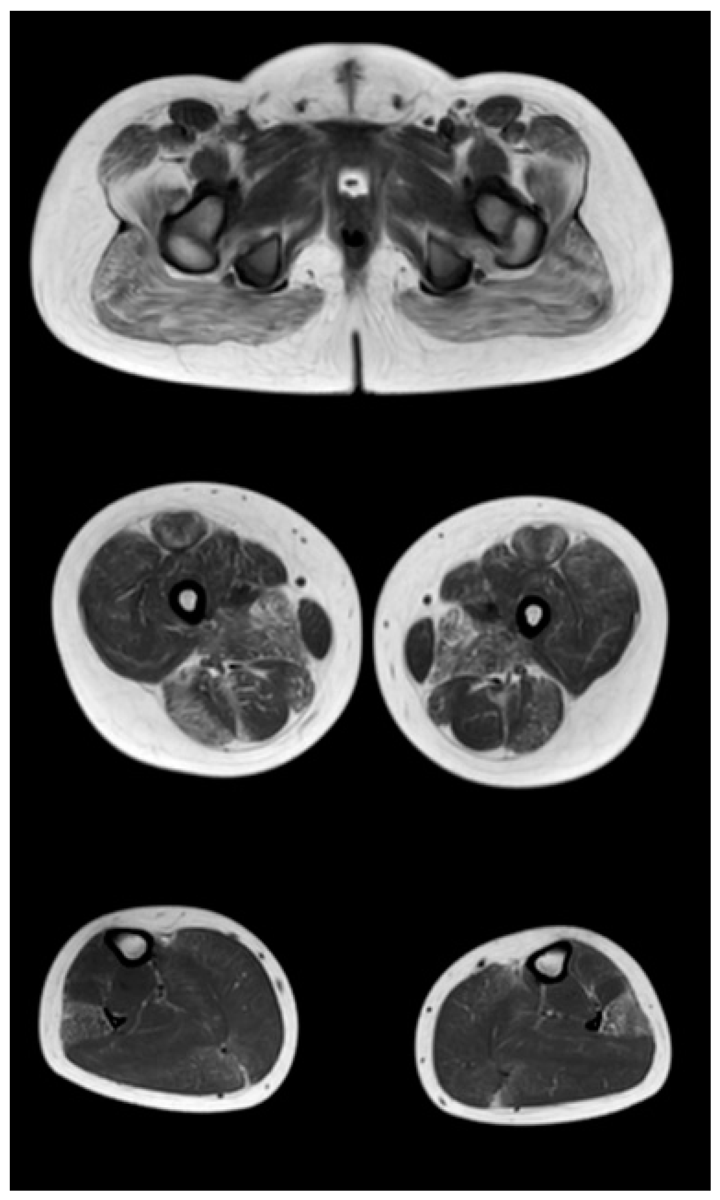 Tomography 08 00076 g004 550
