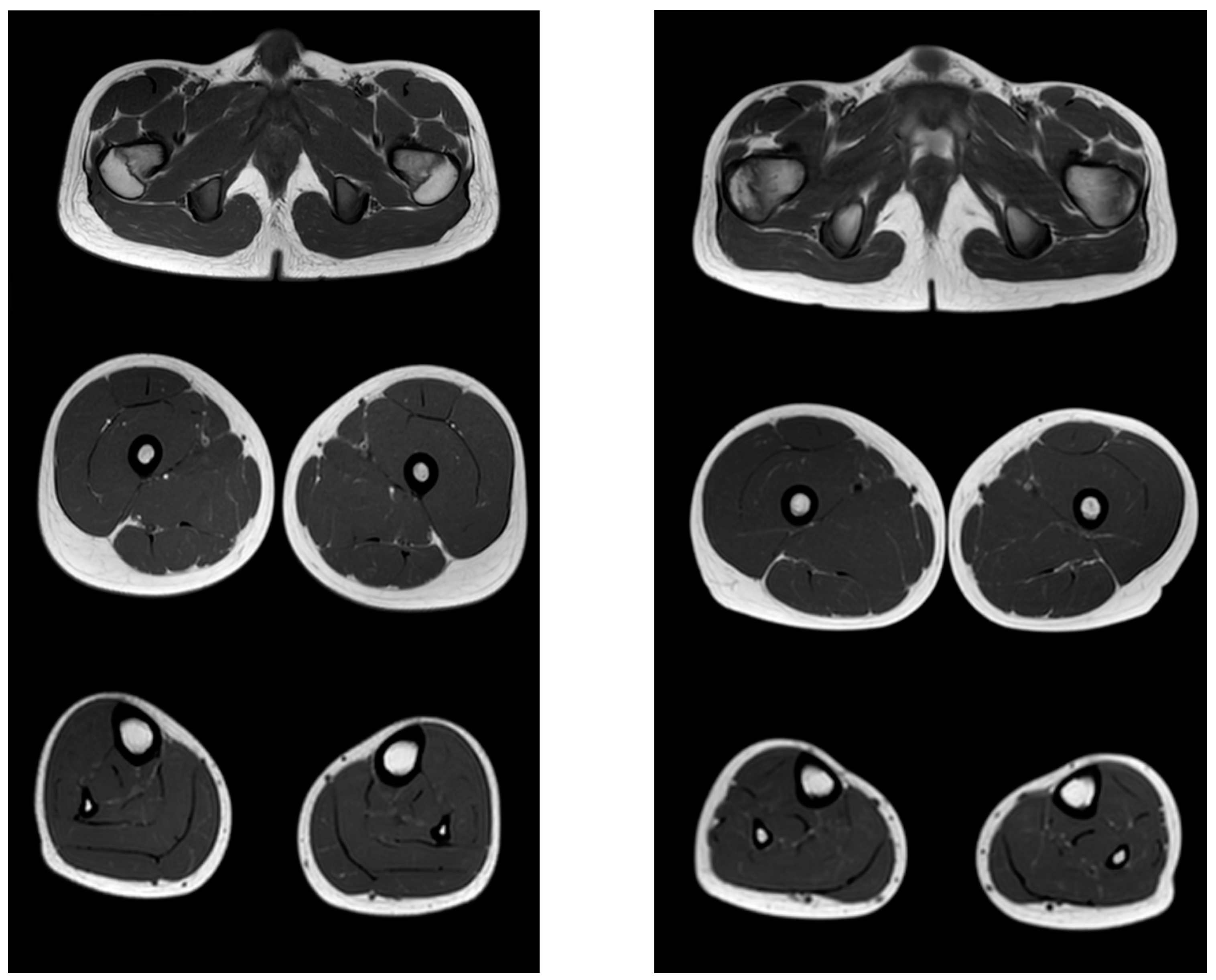 Tomography 08 00076 g006 550