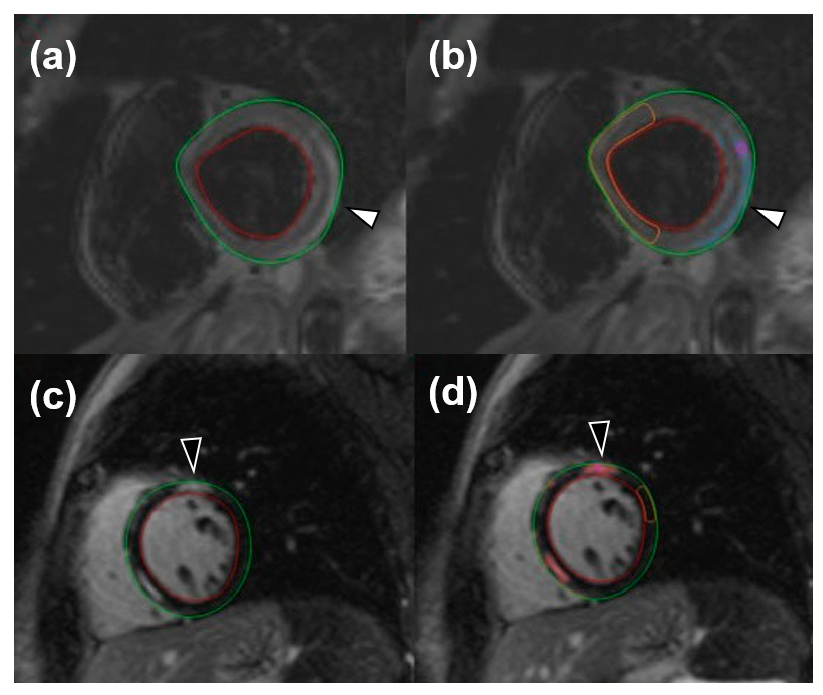 Tomography 08 00078 g001 550