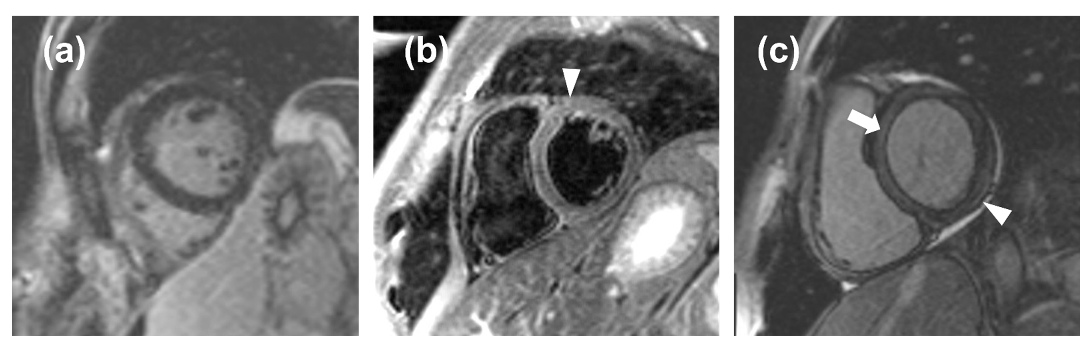 Tomography 08 00078 g005 550
